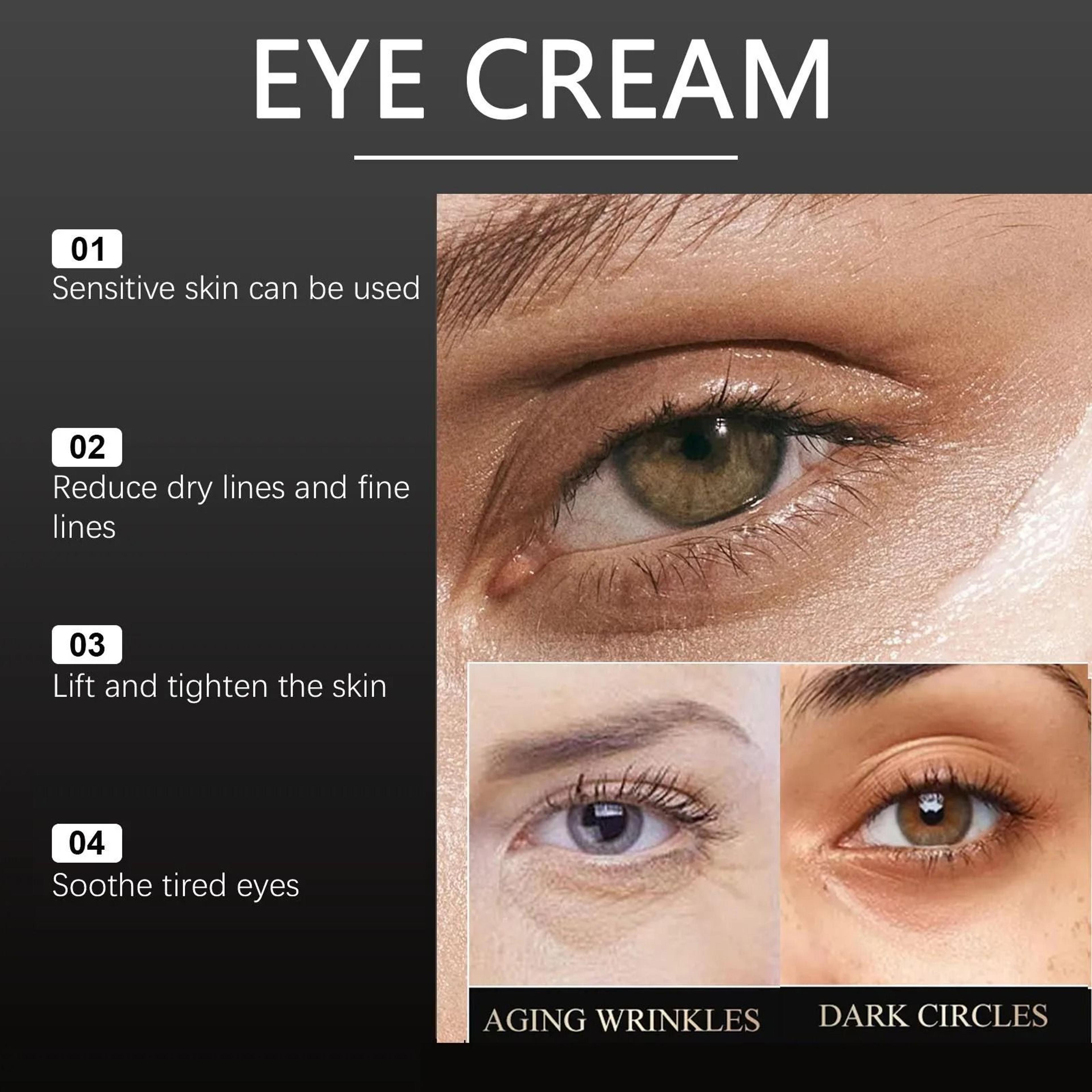 Intensive Eye Rescue Cream  Advanced Dark Circle  Puffiness Correction 5
