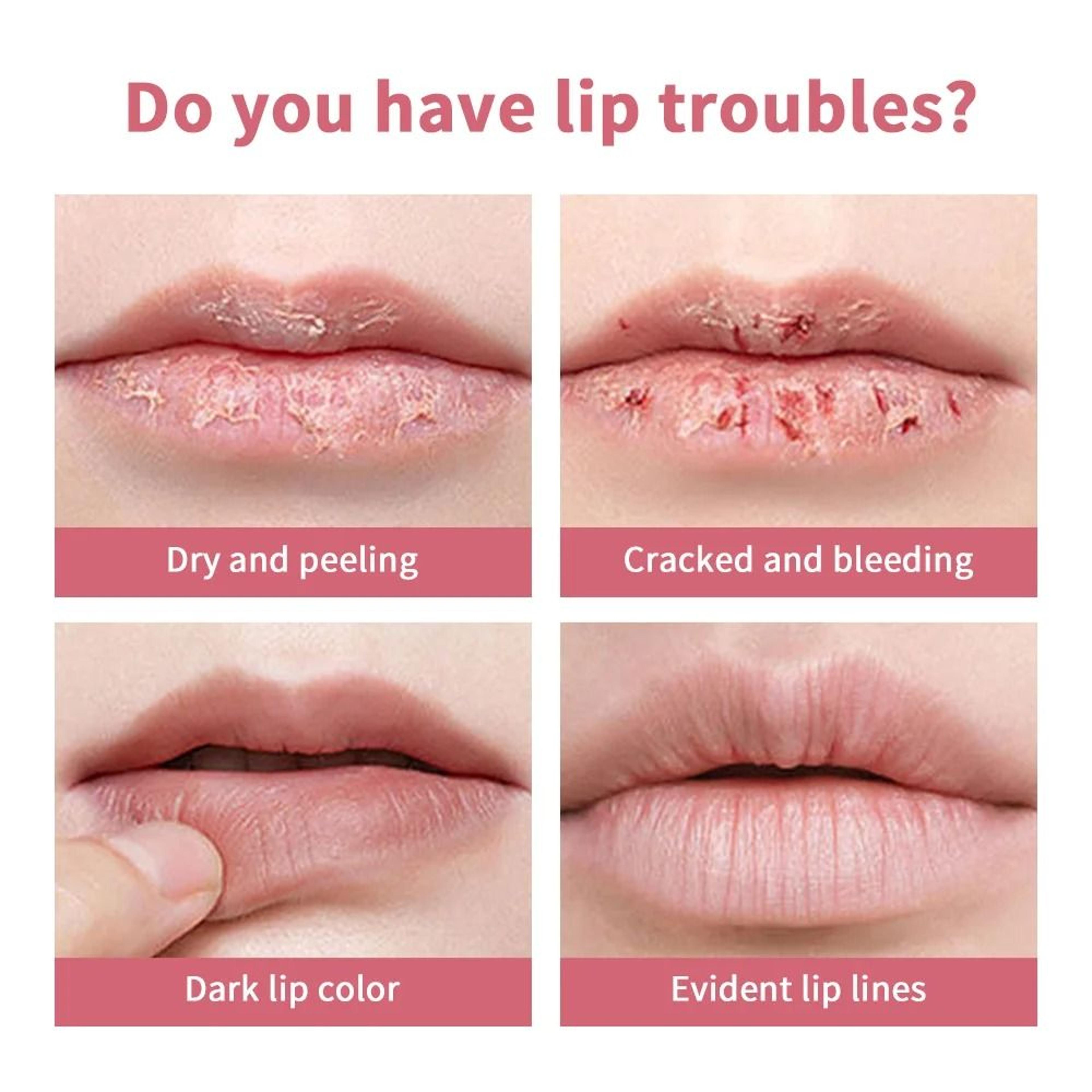 Honey Infused Pink Tinted Lip Balm  Intensive Repair  Powerful Lip Repulper 3