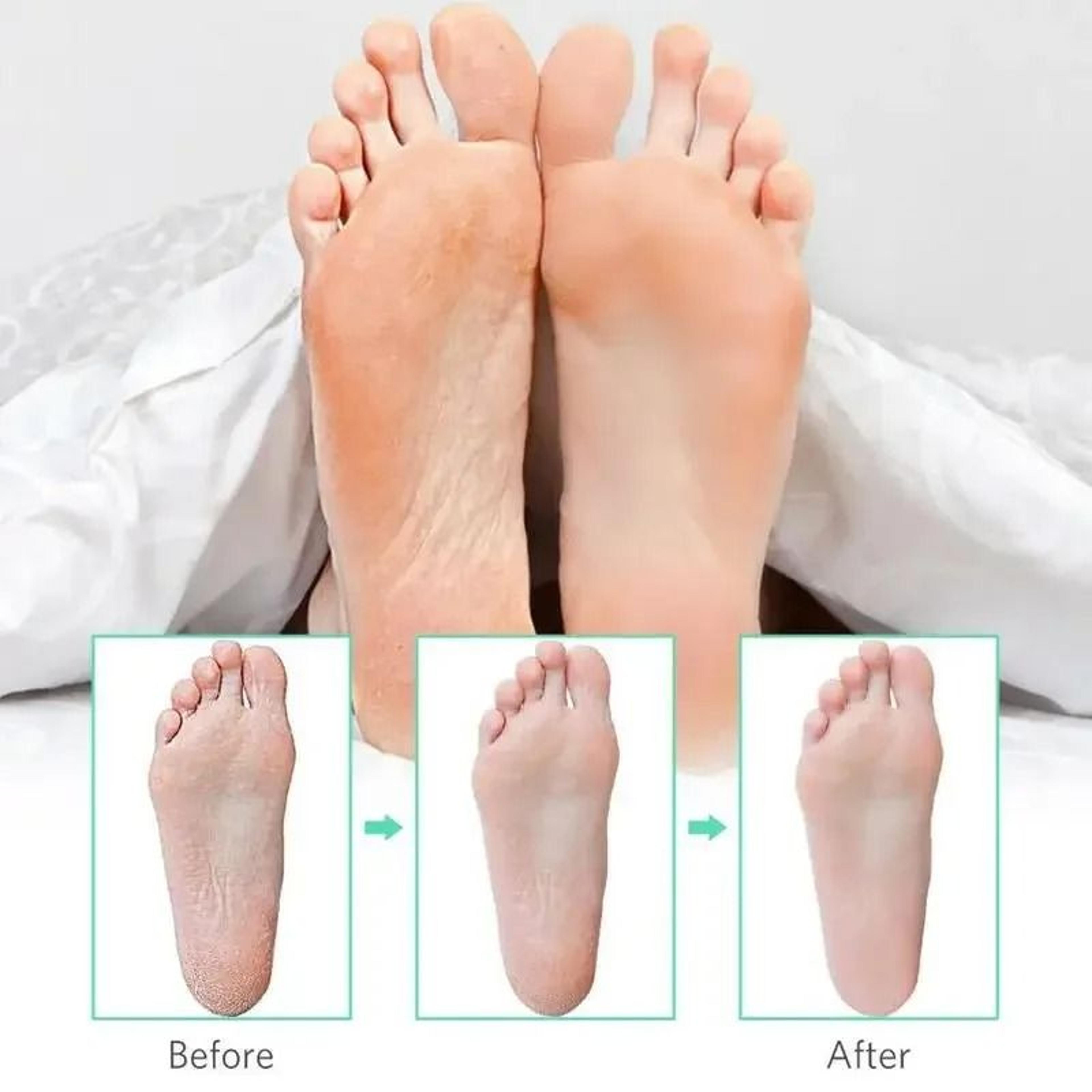 Stainless Steel Foot Rasp  Callus Remover 4