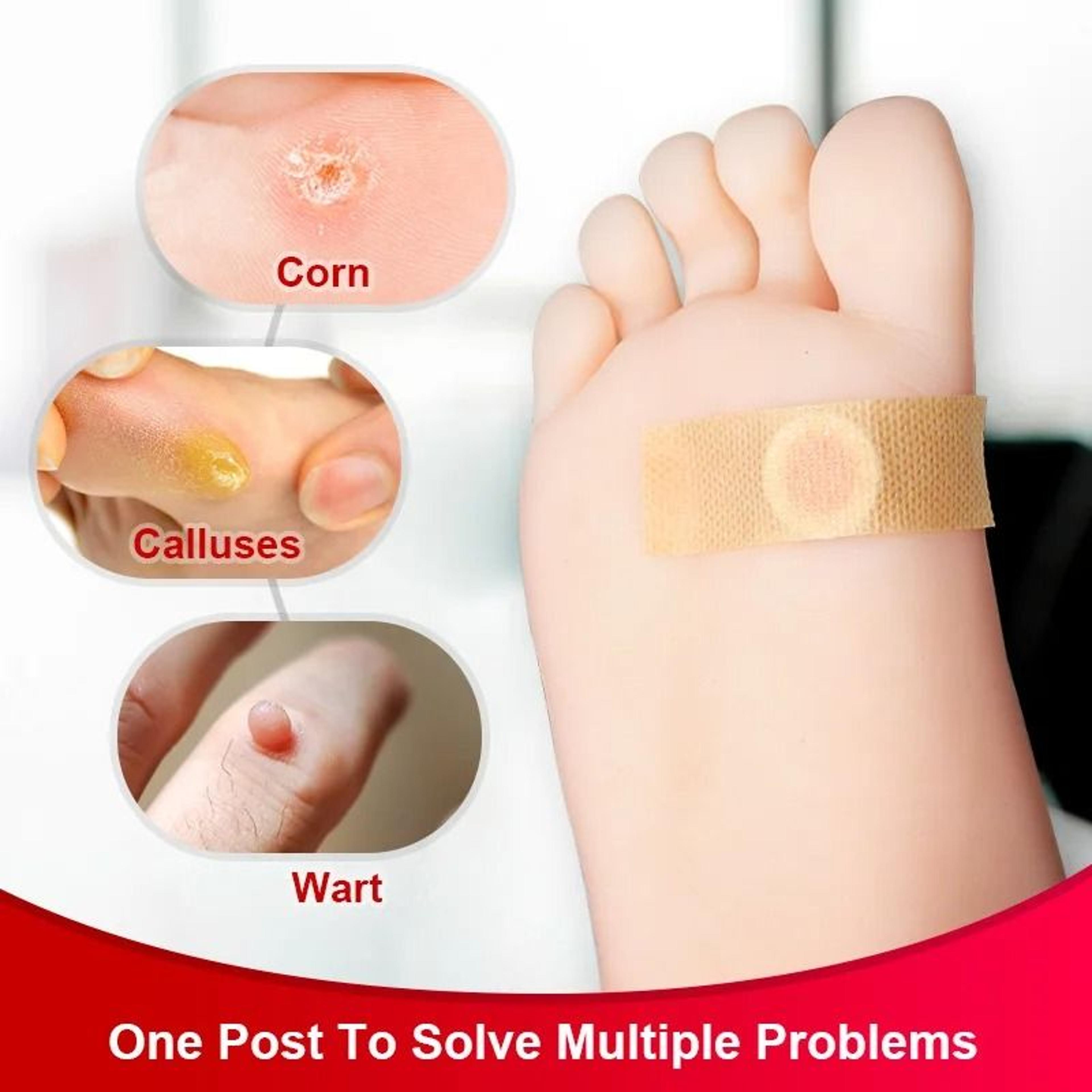 Total Comfort Corn  Callus Removal Adhesive Patches 4