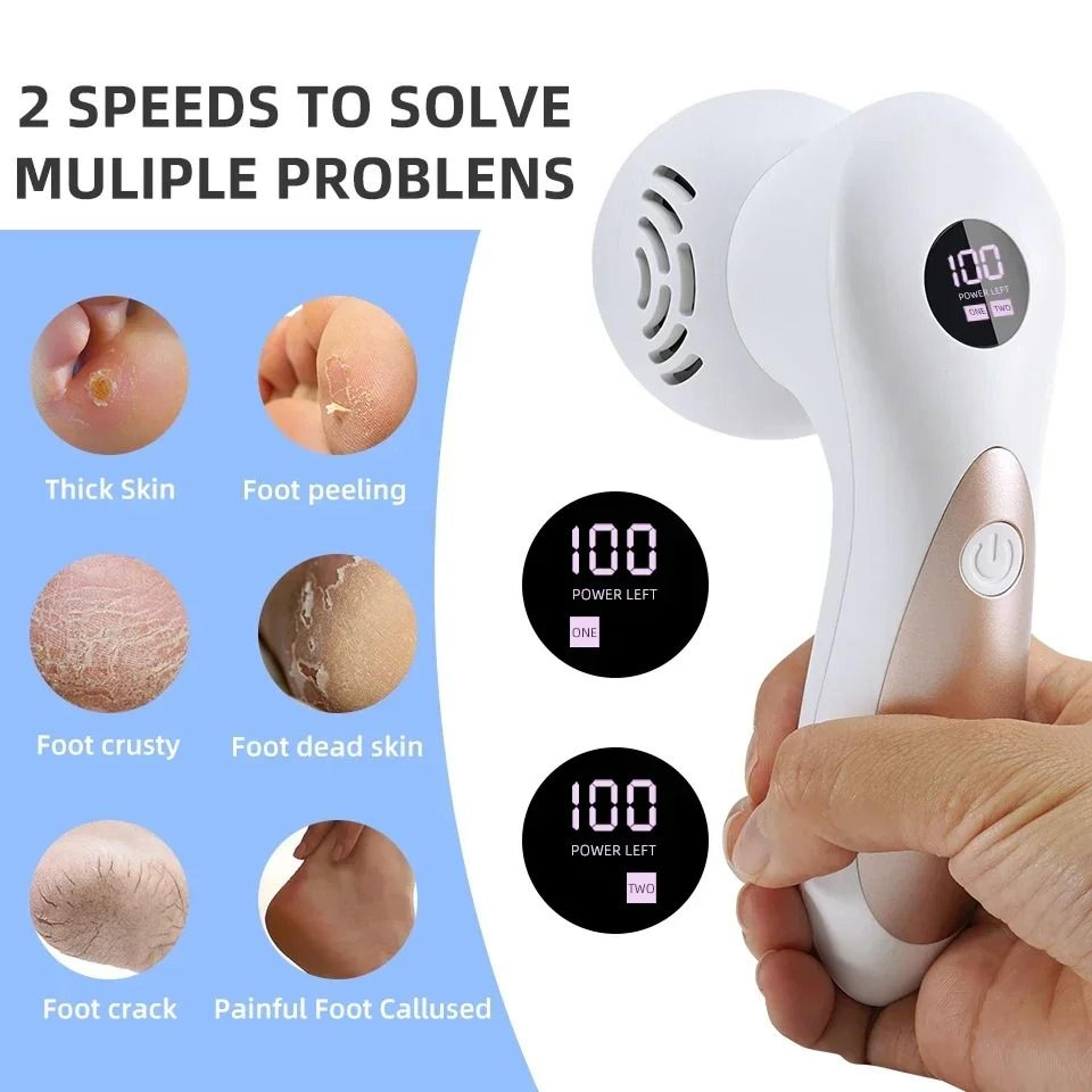 Precision Electric Power Callus Remover  Heel Restorer 1