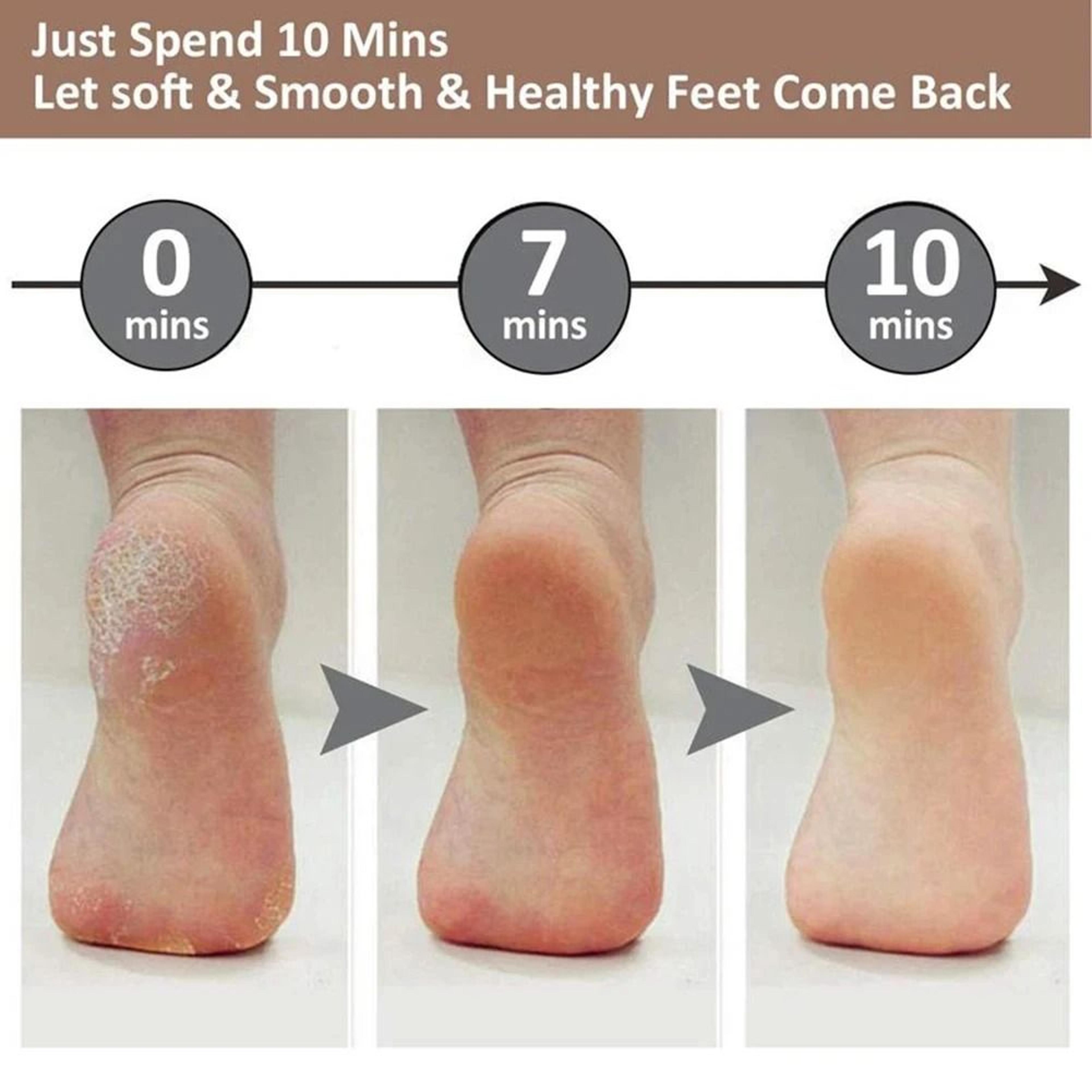 Electric Foot Callus Remover  Rechargeable Pedicure Scrubber  Professional Exfoliator For Smooth  H 2