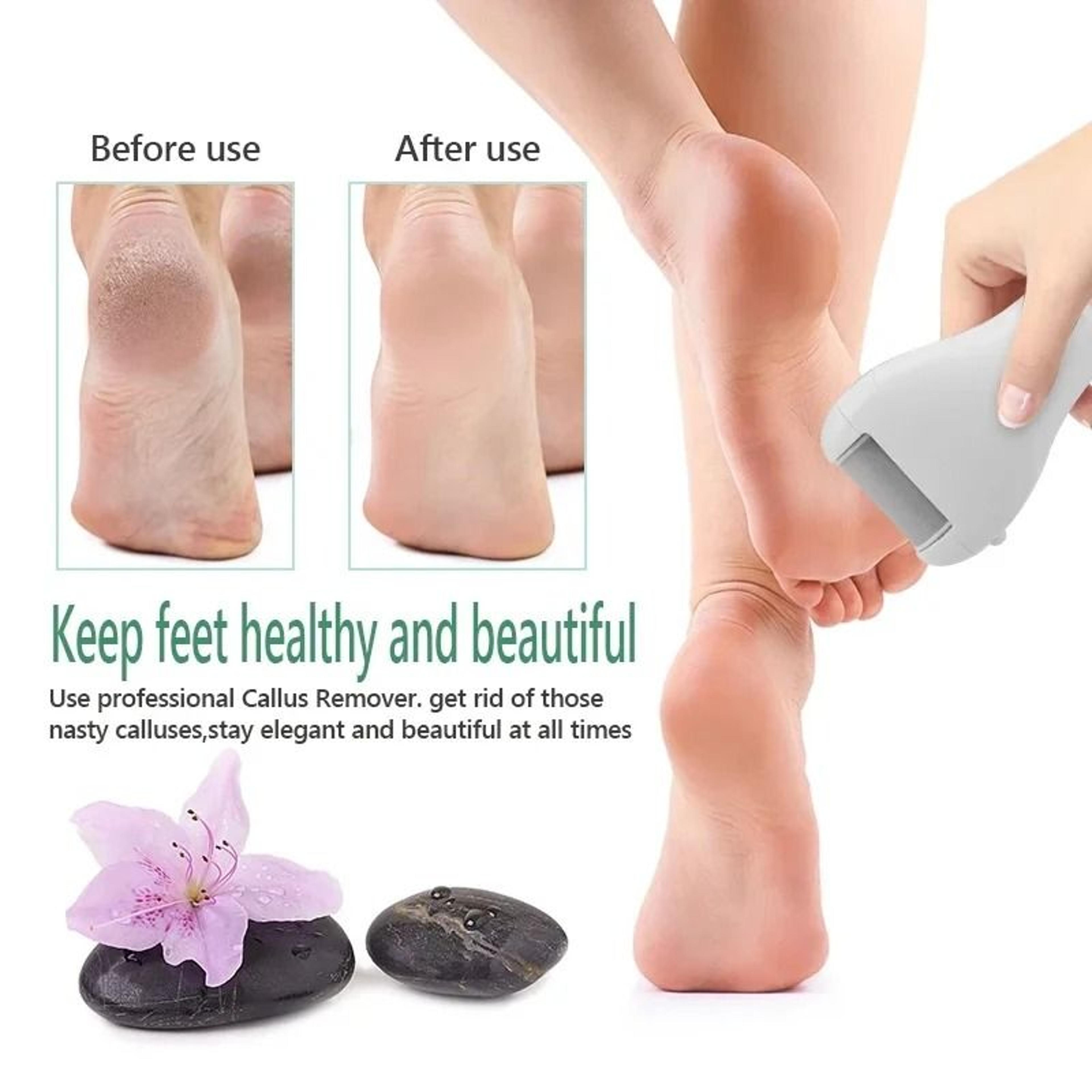 USBRechargeable Electric Foot Grinder  Callus Remover 4