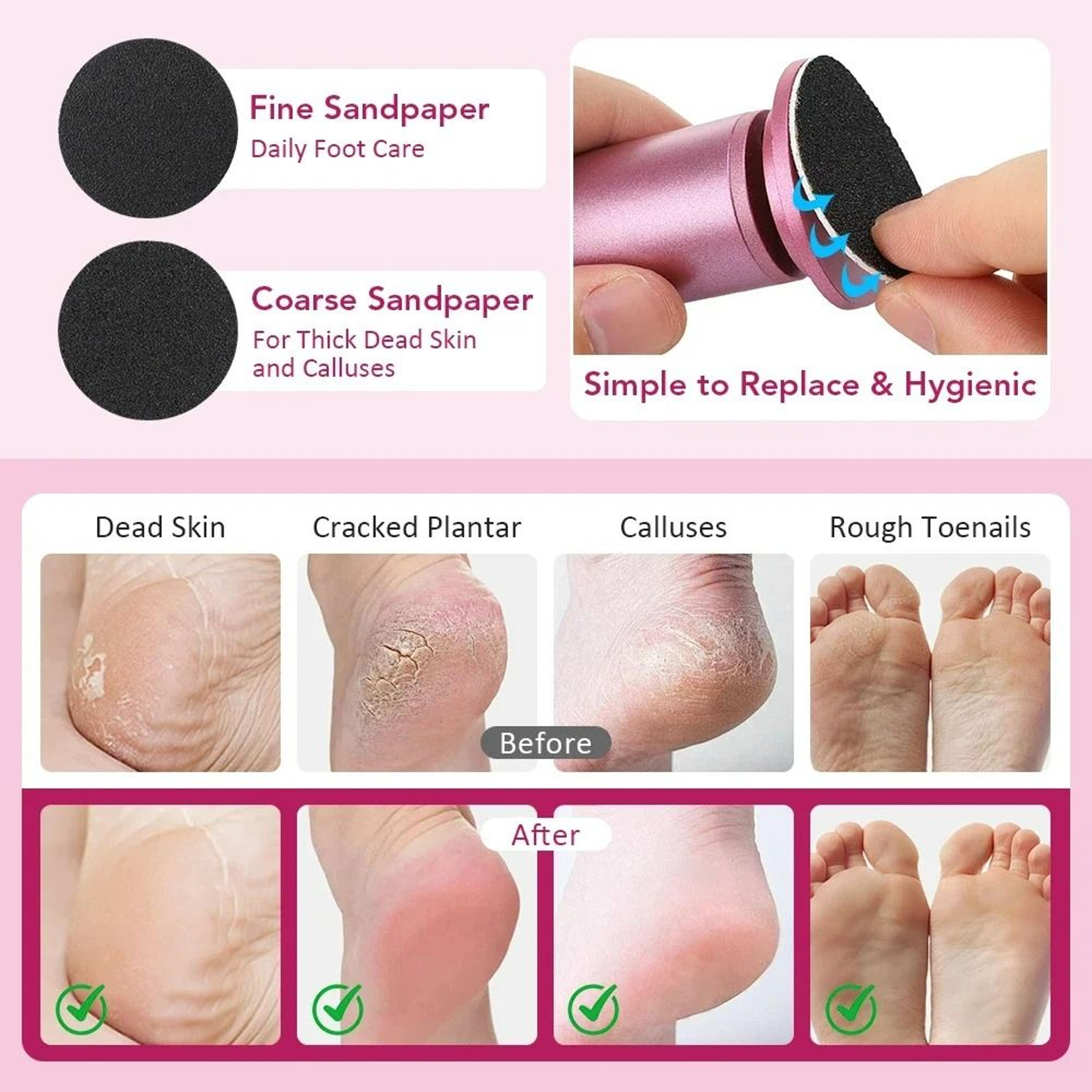 Electronic Foot Grinder  Complete Pedicure Tool Set 3