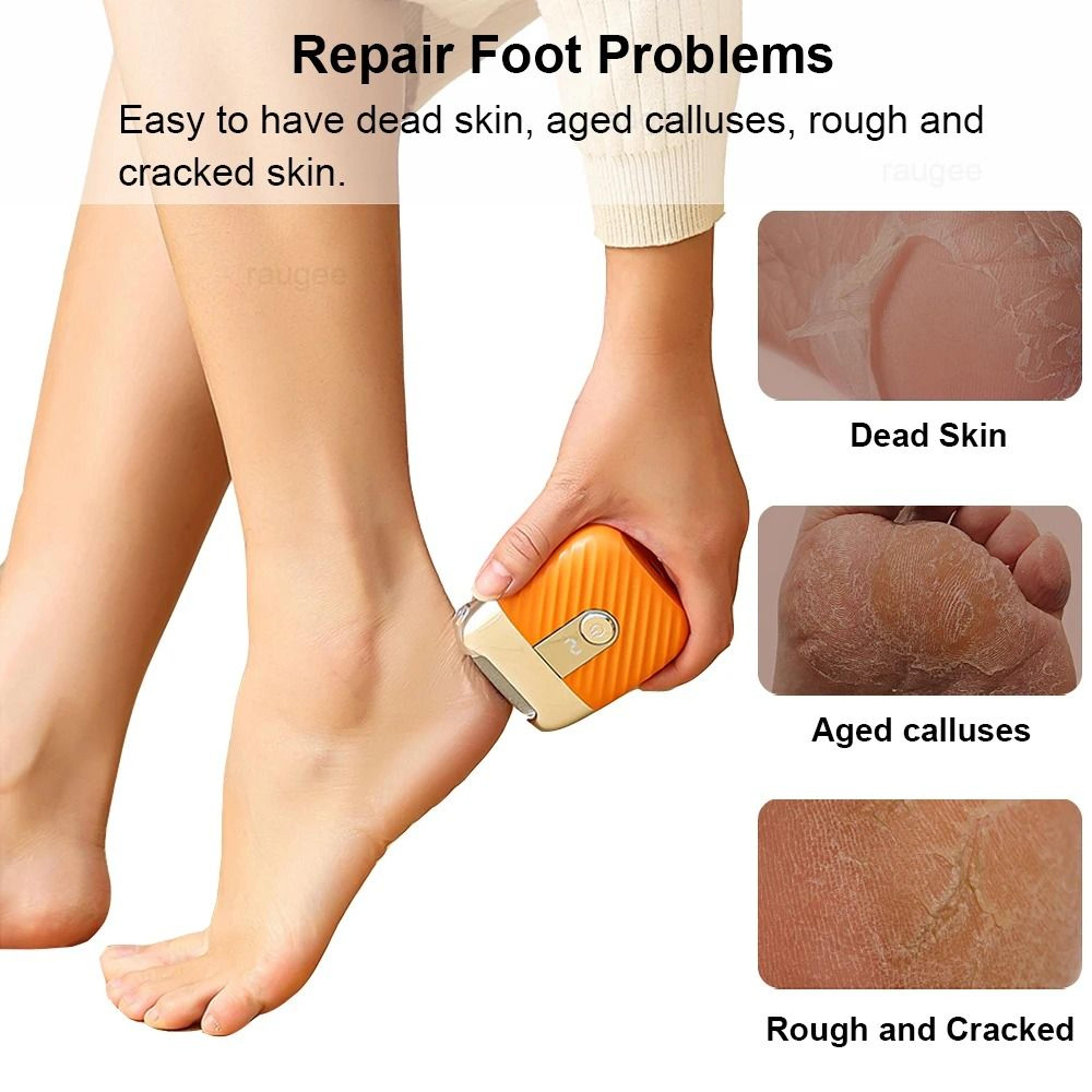 Electric Rechargeable Foot Callus Remover 2