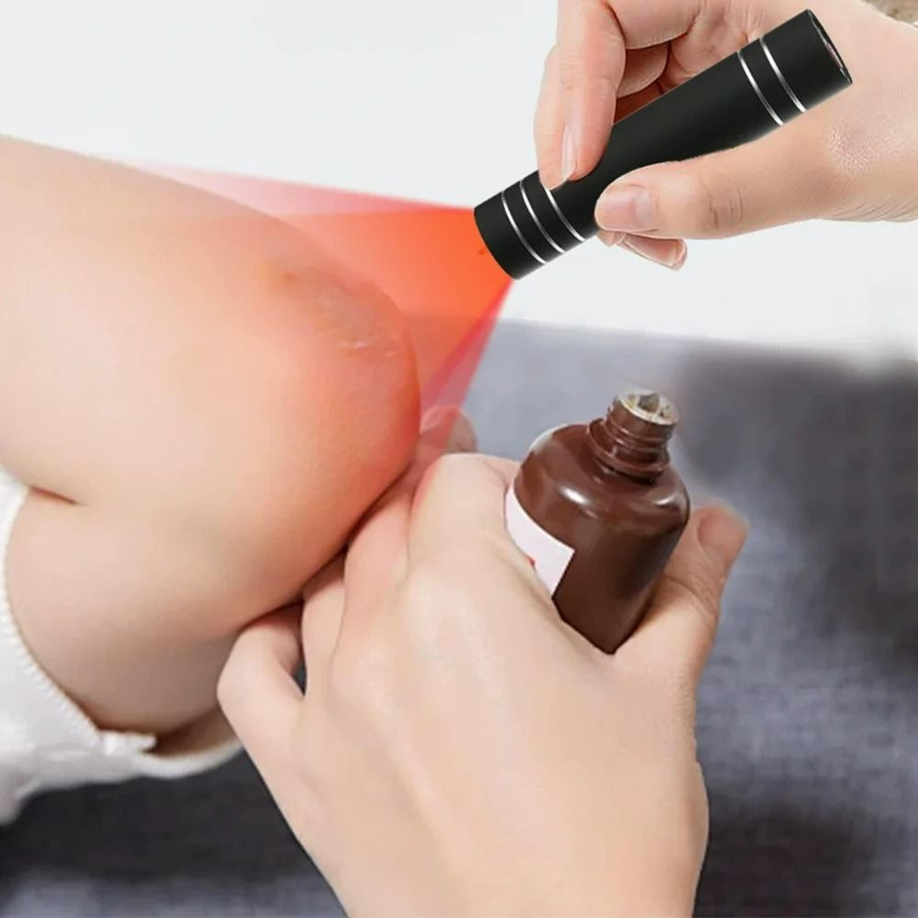 Red  Blue Light Therapy Canker Sore Device 2