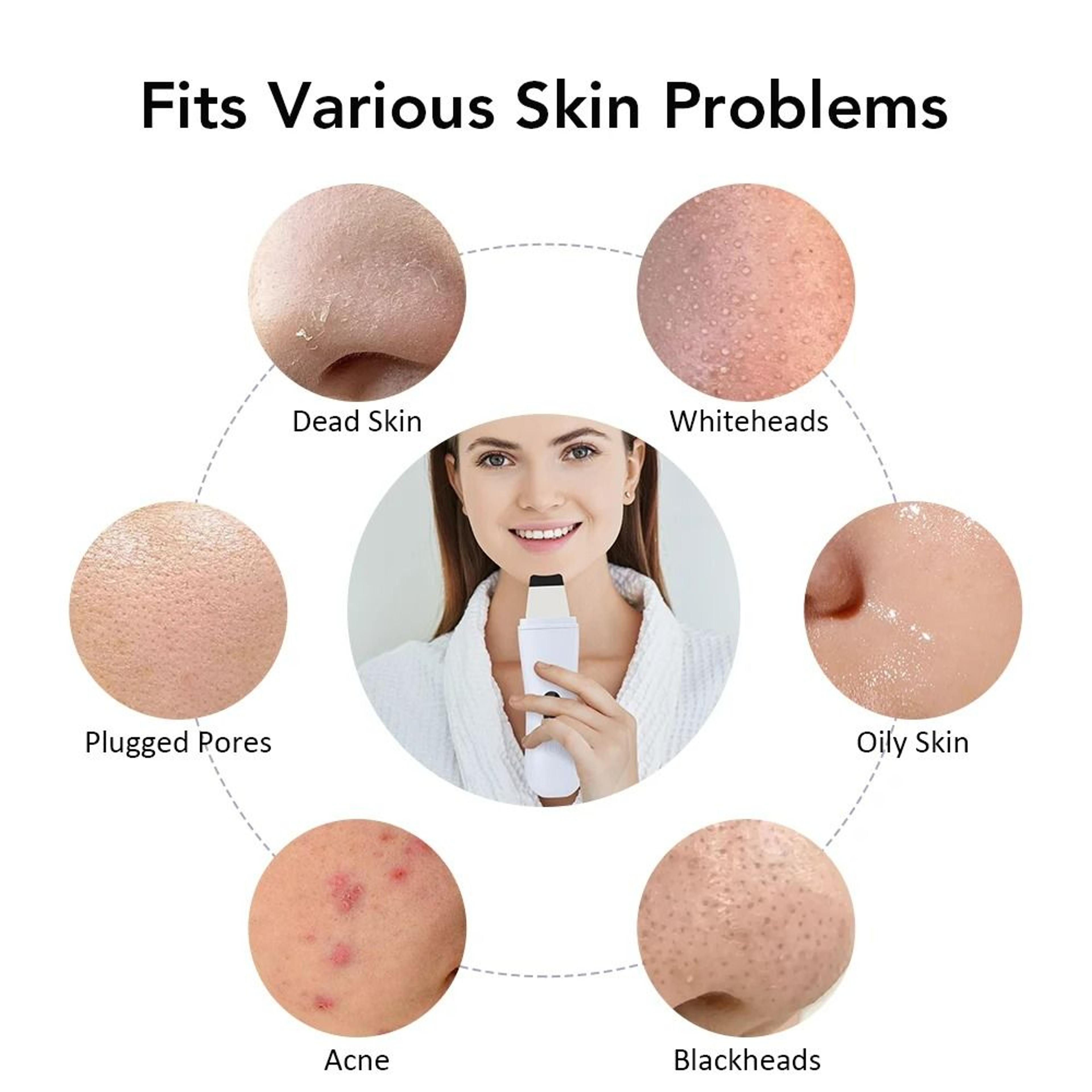 Elite Ultrasonic Facial Skin Scrubber  Pore Cleaner 3