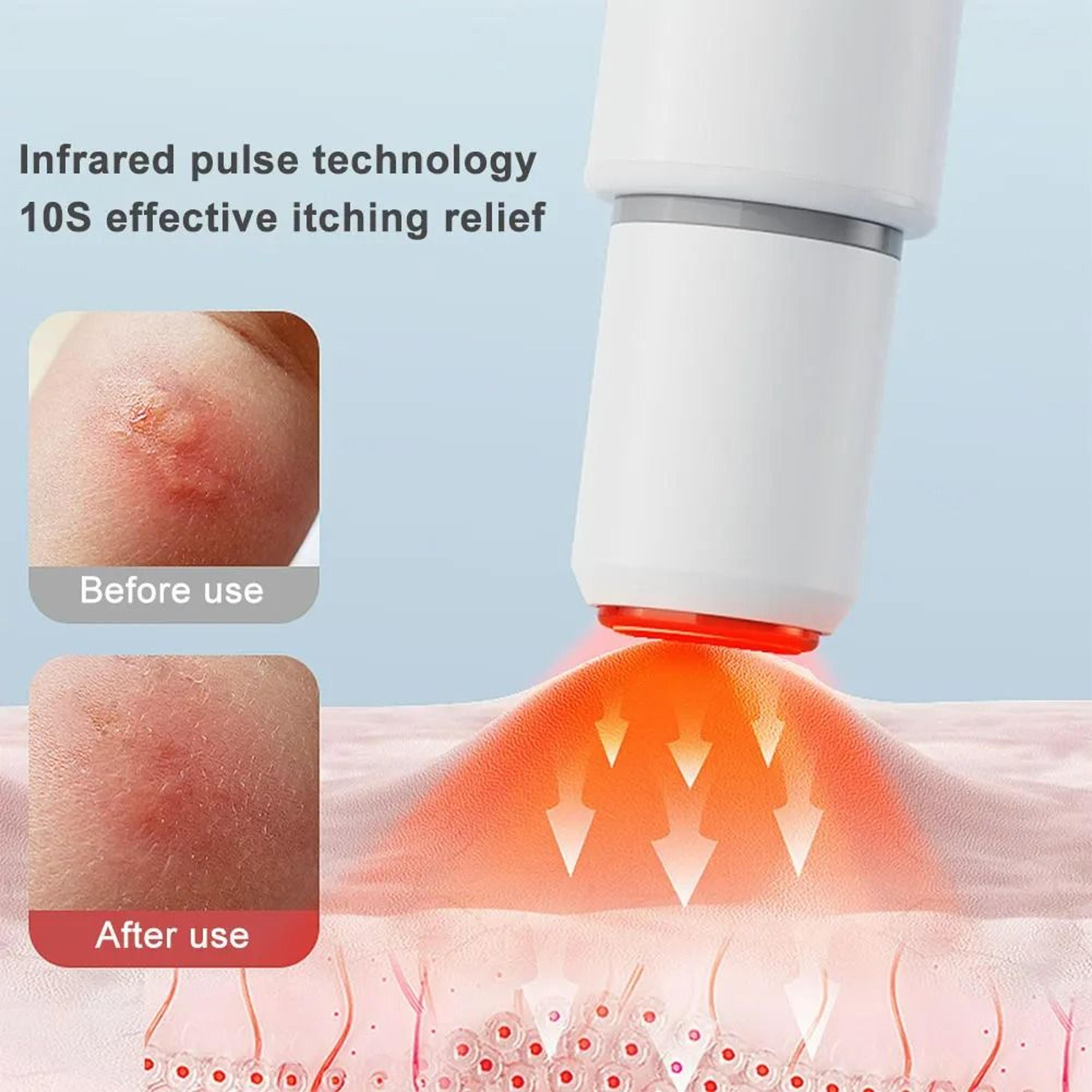 Portable Mosquito Bite Heat Reliever Pen 4