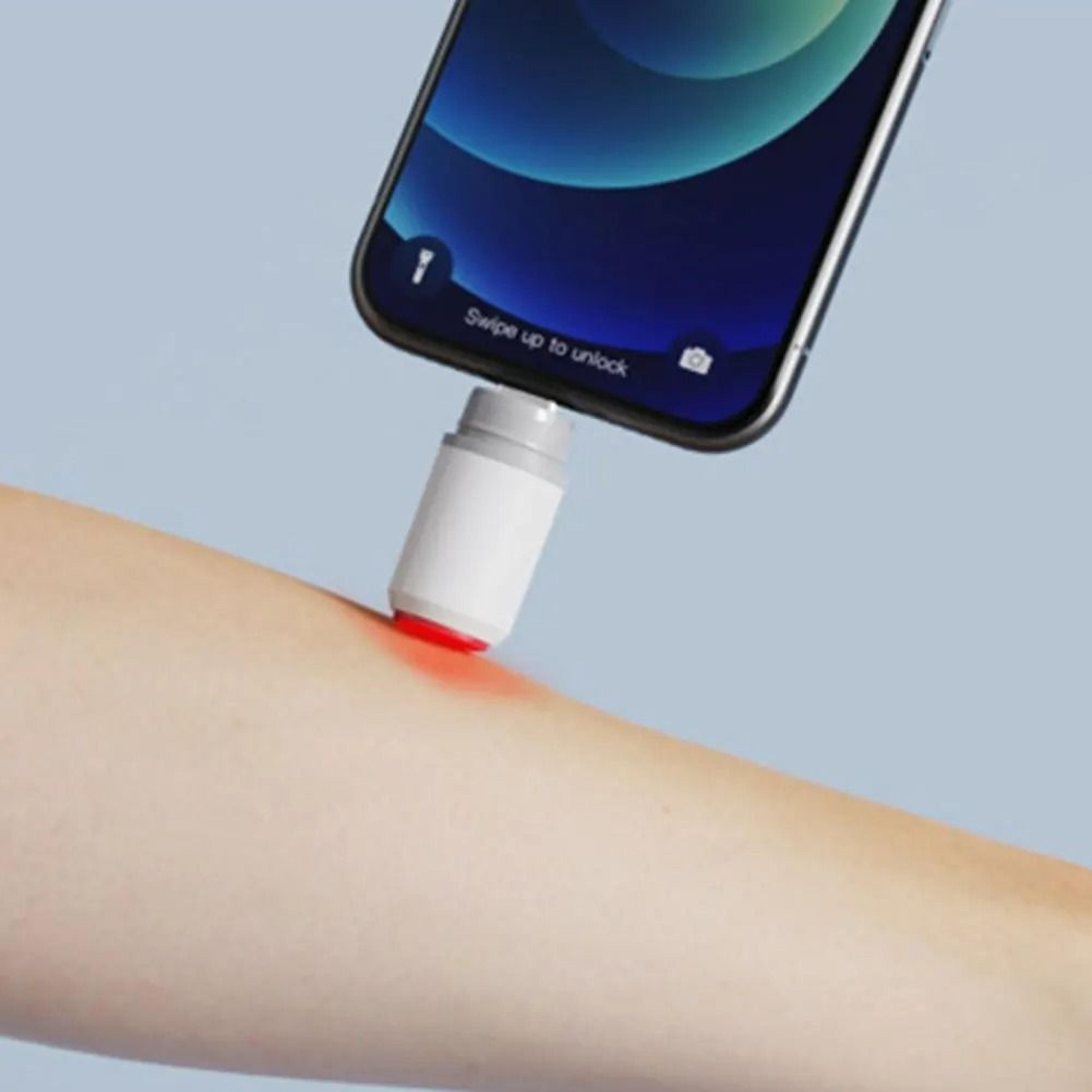 Portable Electronic Mosquito Bite AntiItch Reliever Pen 5