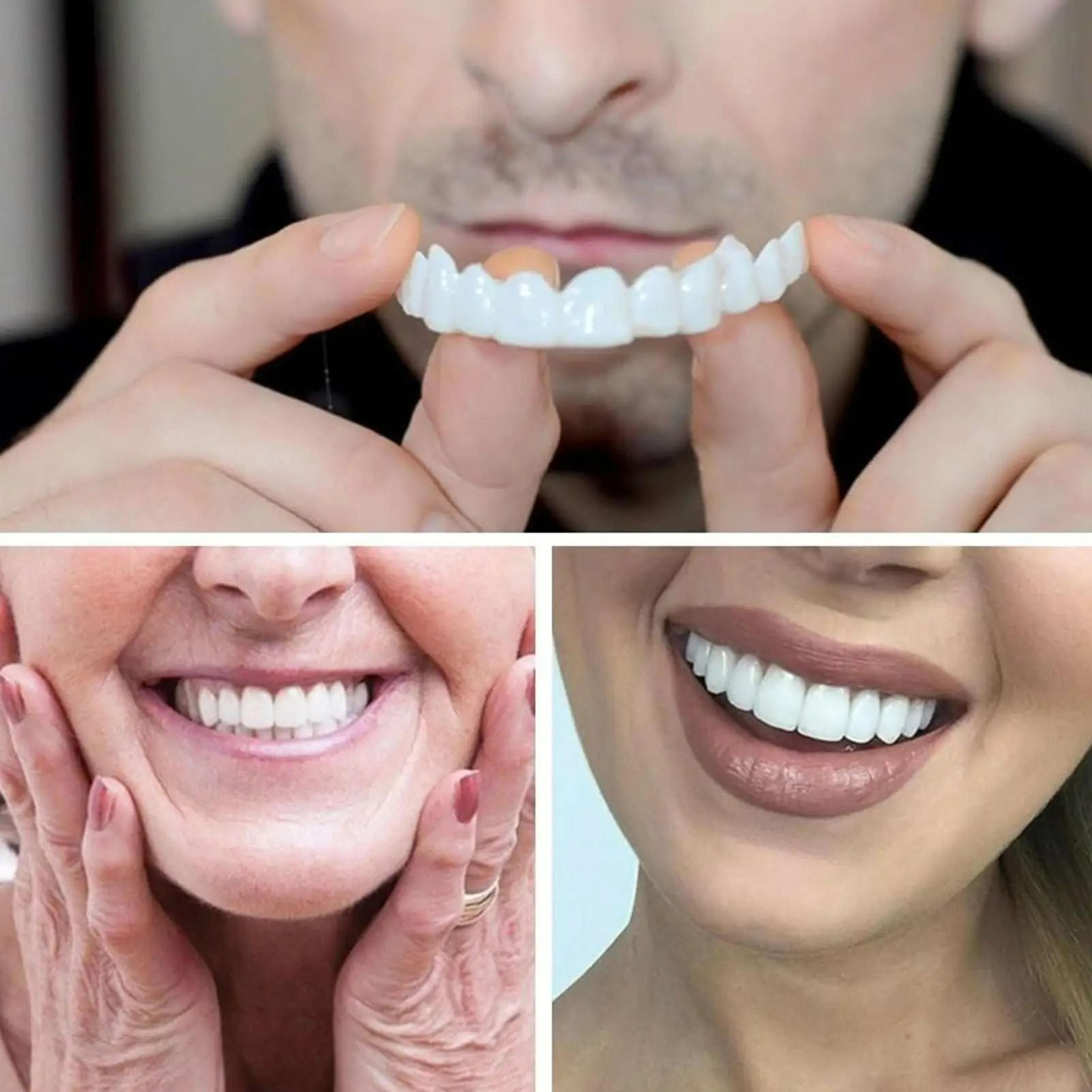 Instant Cosmetic Teeth Veneers Kit 0