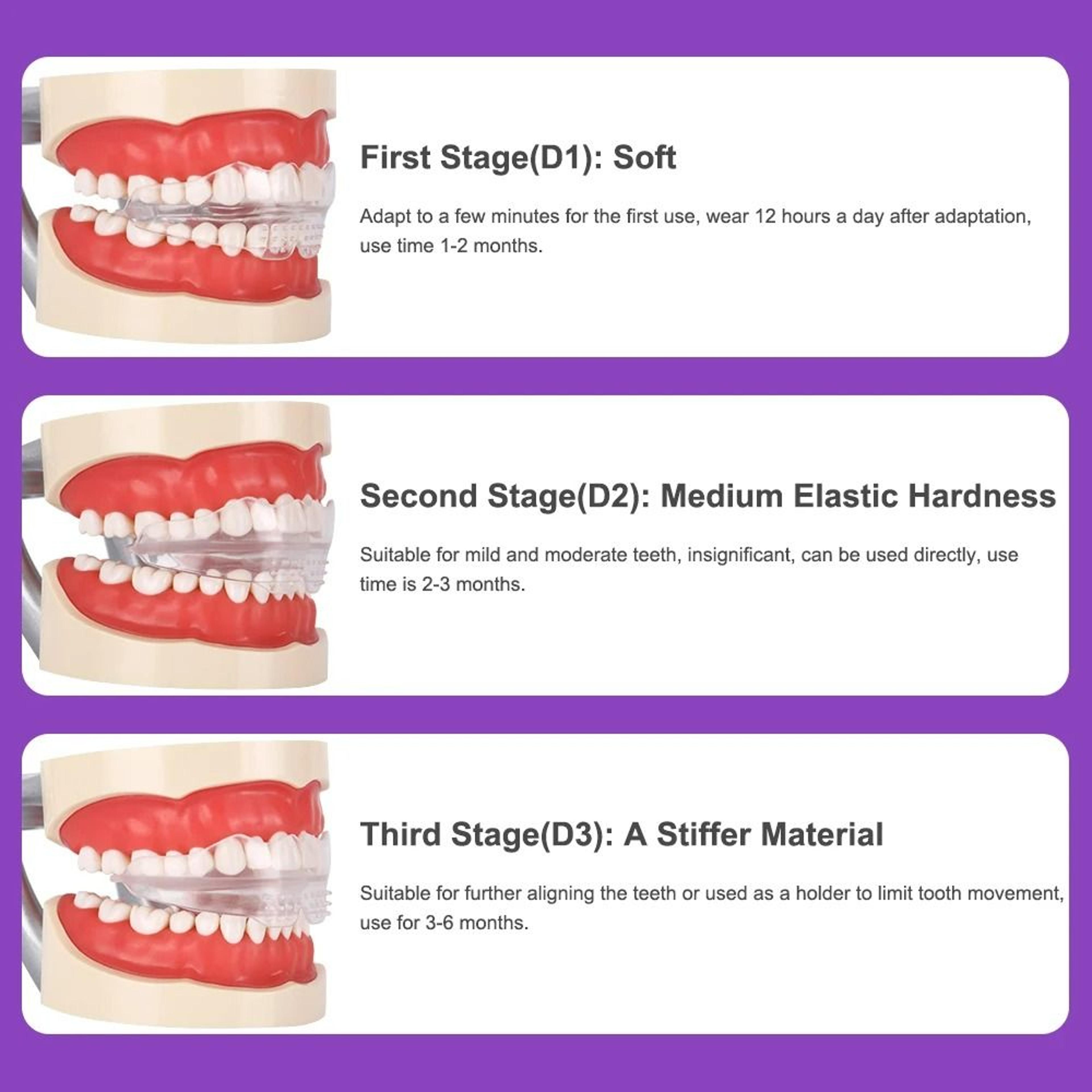 3Stage Clear Teeth Straightener Set 3