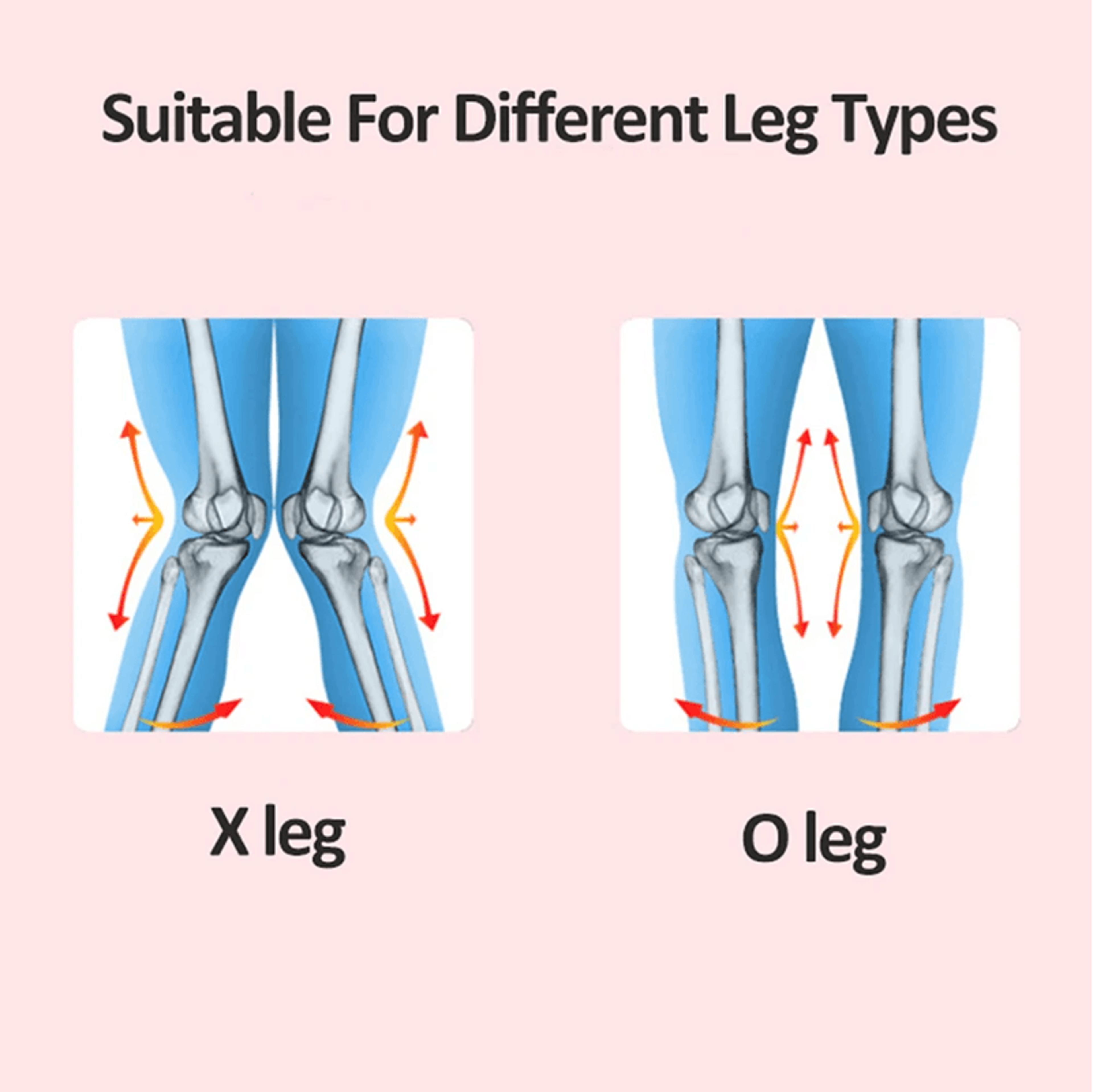TIKE O X Leg Correction Band For Straightening Bow Legs Knee Valgum Correction 4