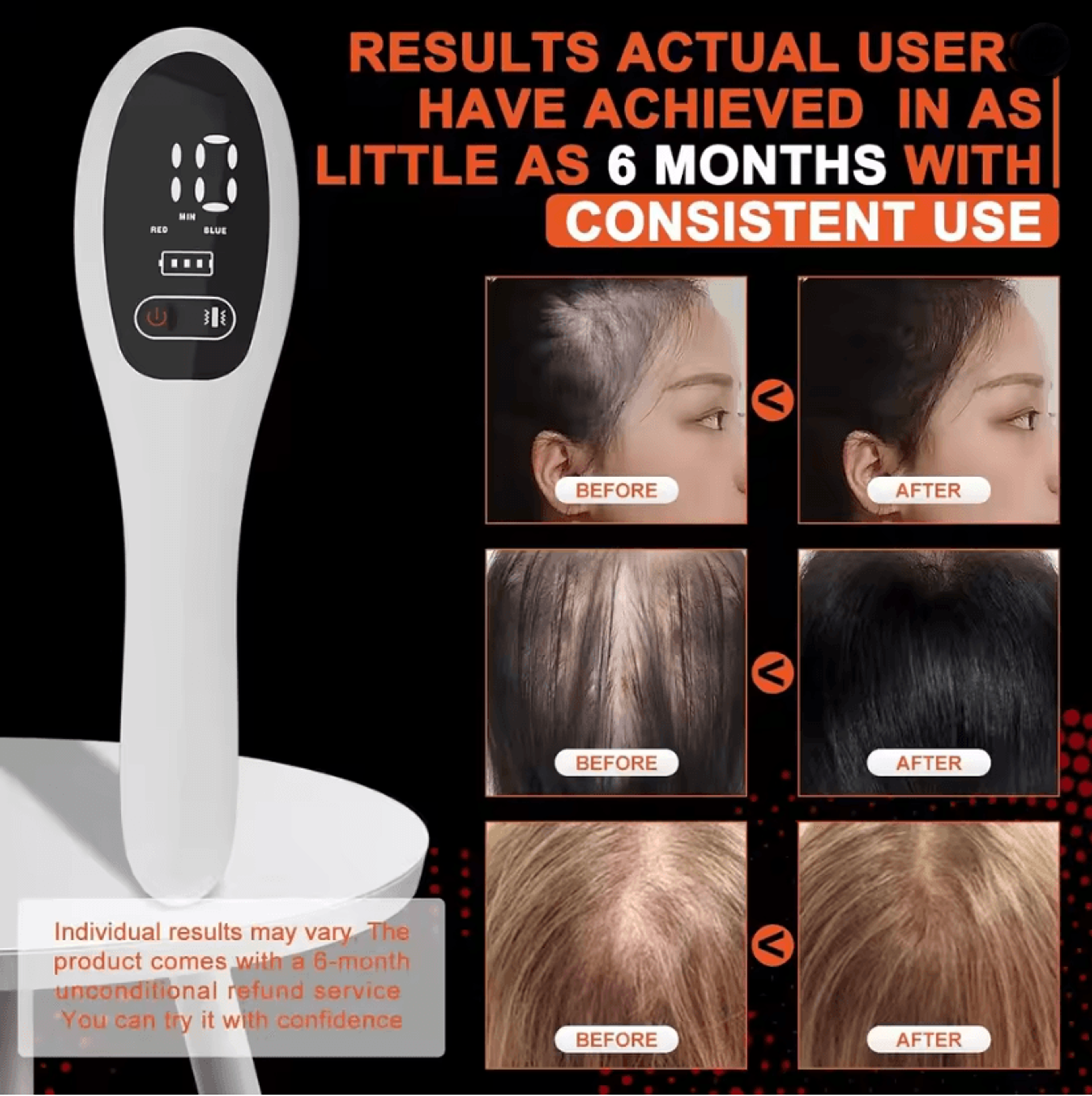 RevitaLaser 650nm Red Light Laser Hair Growth Comb 2