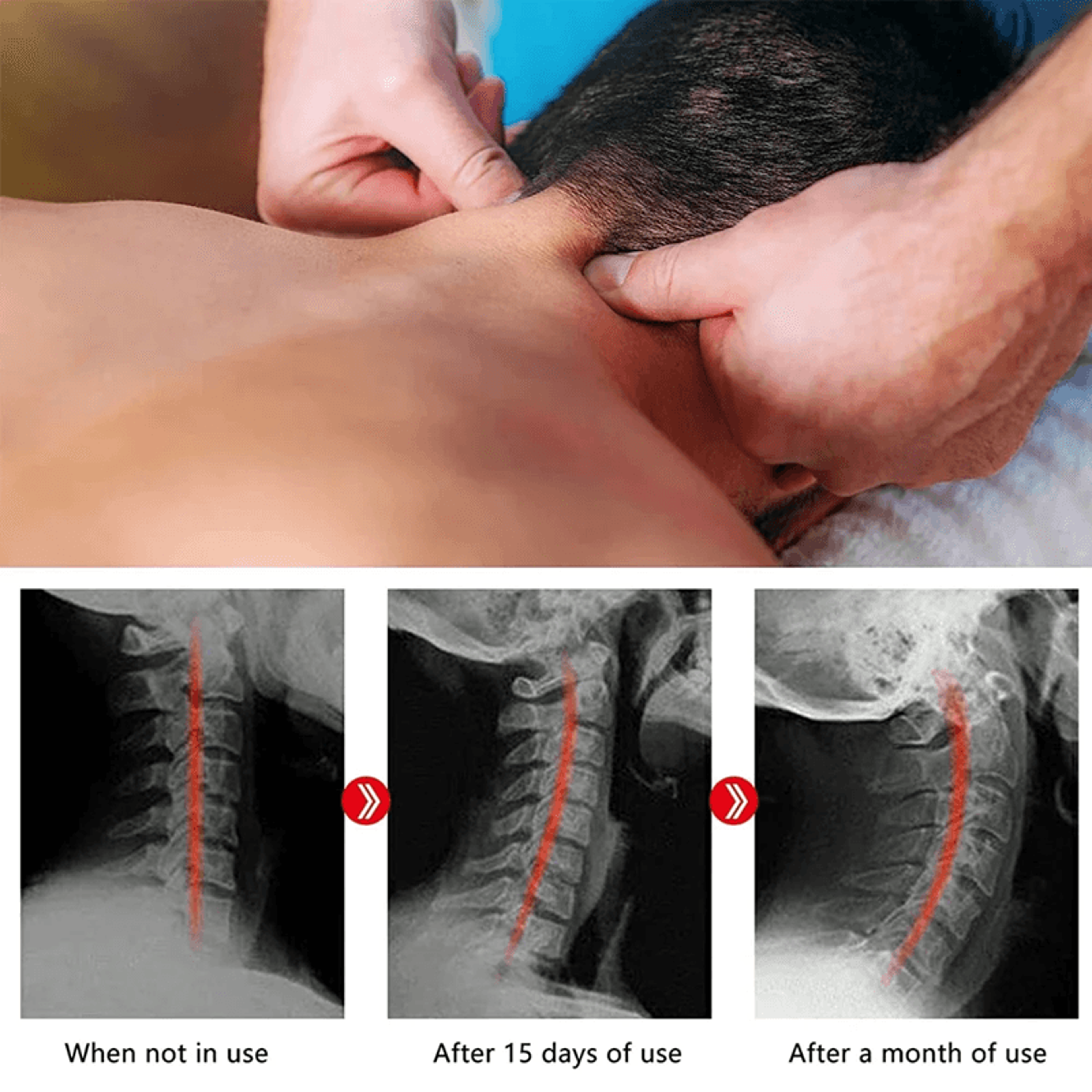 SpineEase Cervical Neck And Shoulder Relaxer 6