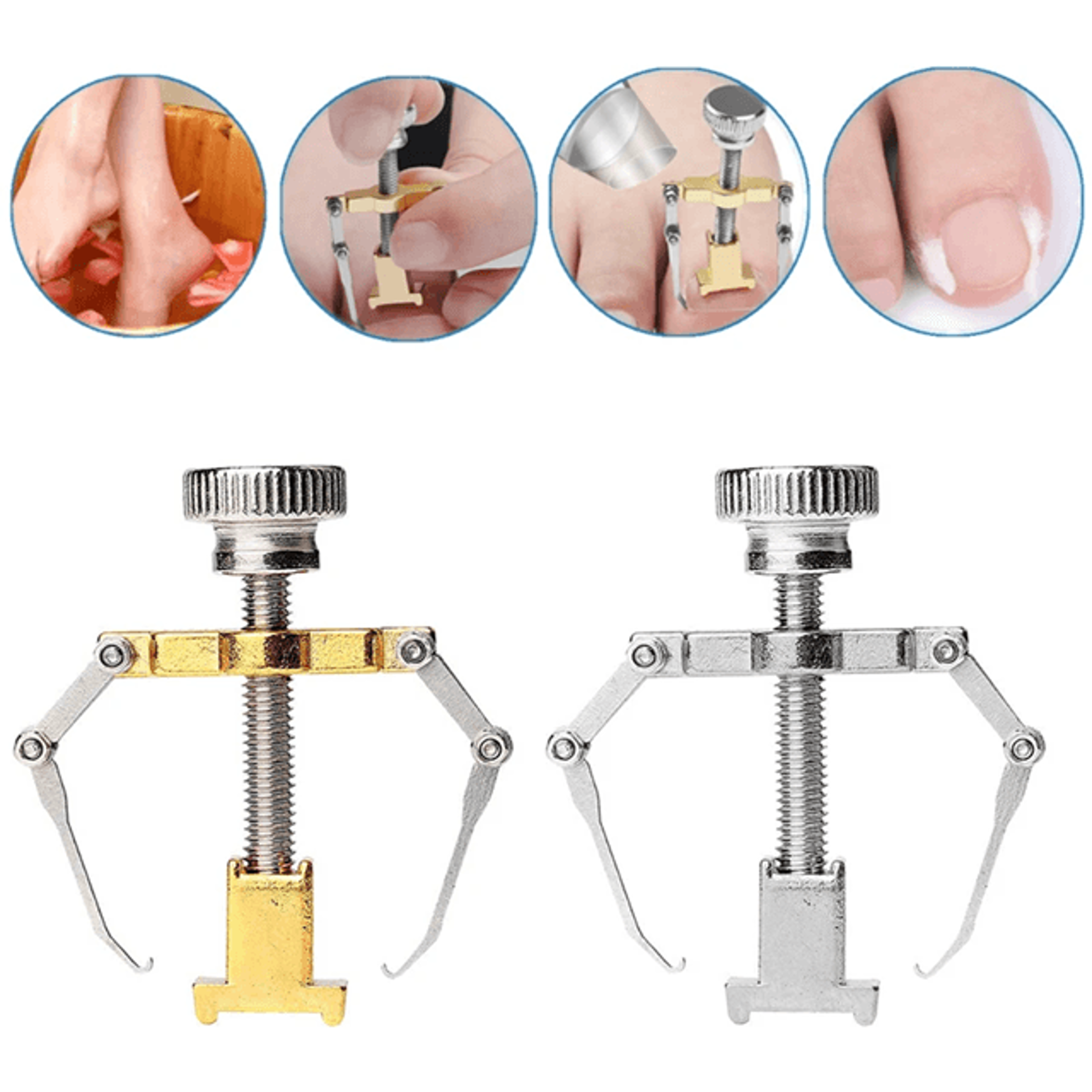Professional Ingrown Toenail Corrector Clip And Stainless Steel Nail Lifter Tool 1