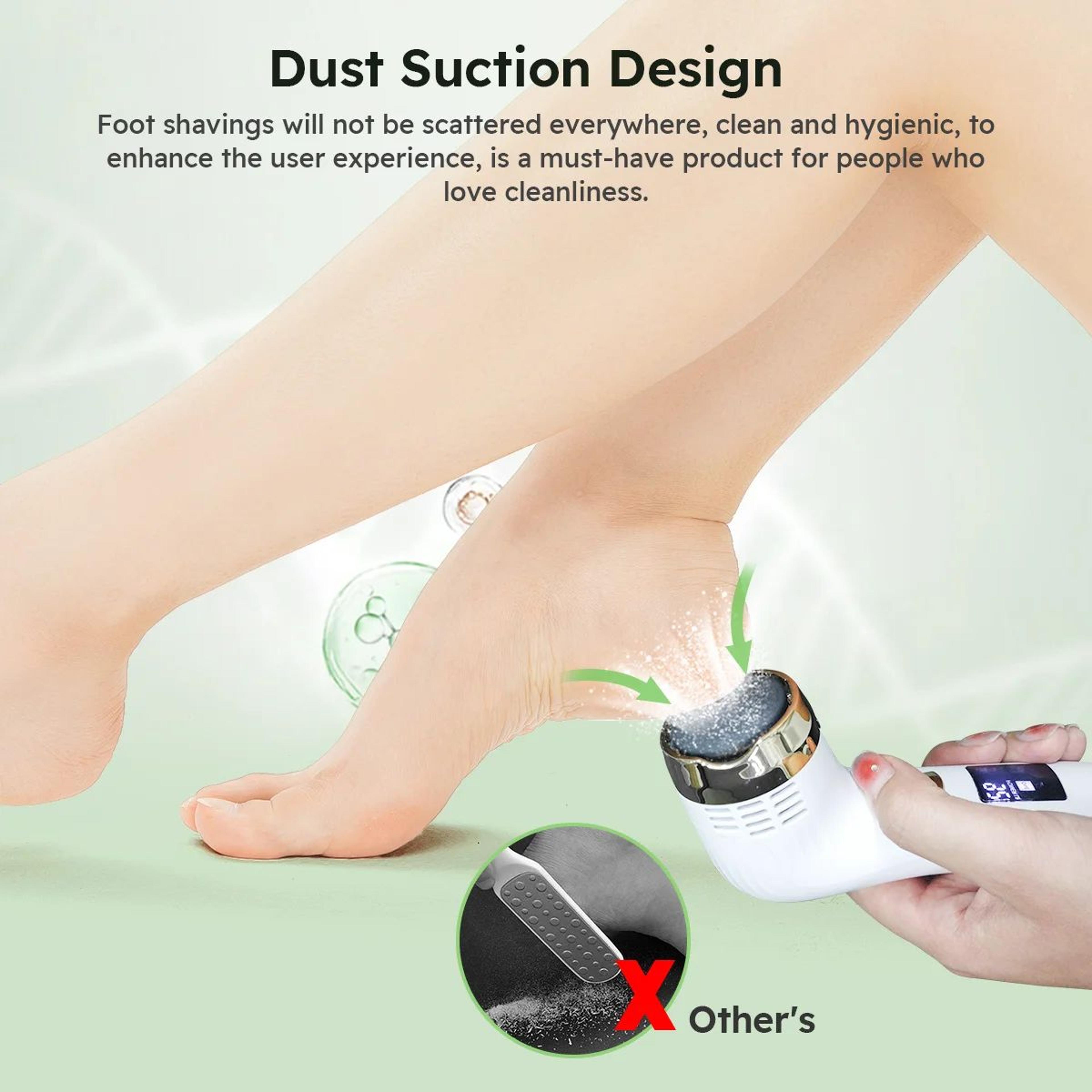 SmoothStep Rechargeable Electric Foot Callus Remover With Vacuum 4