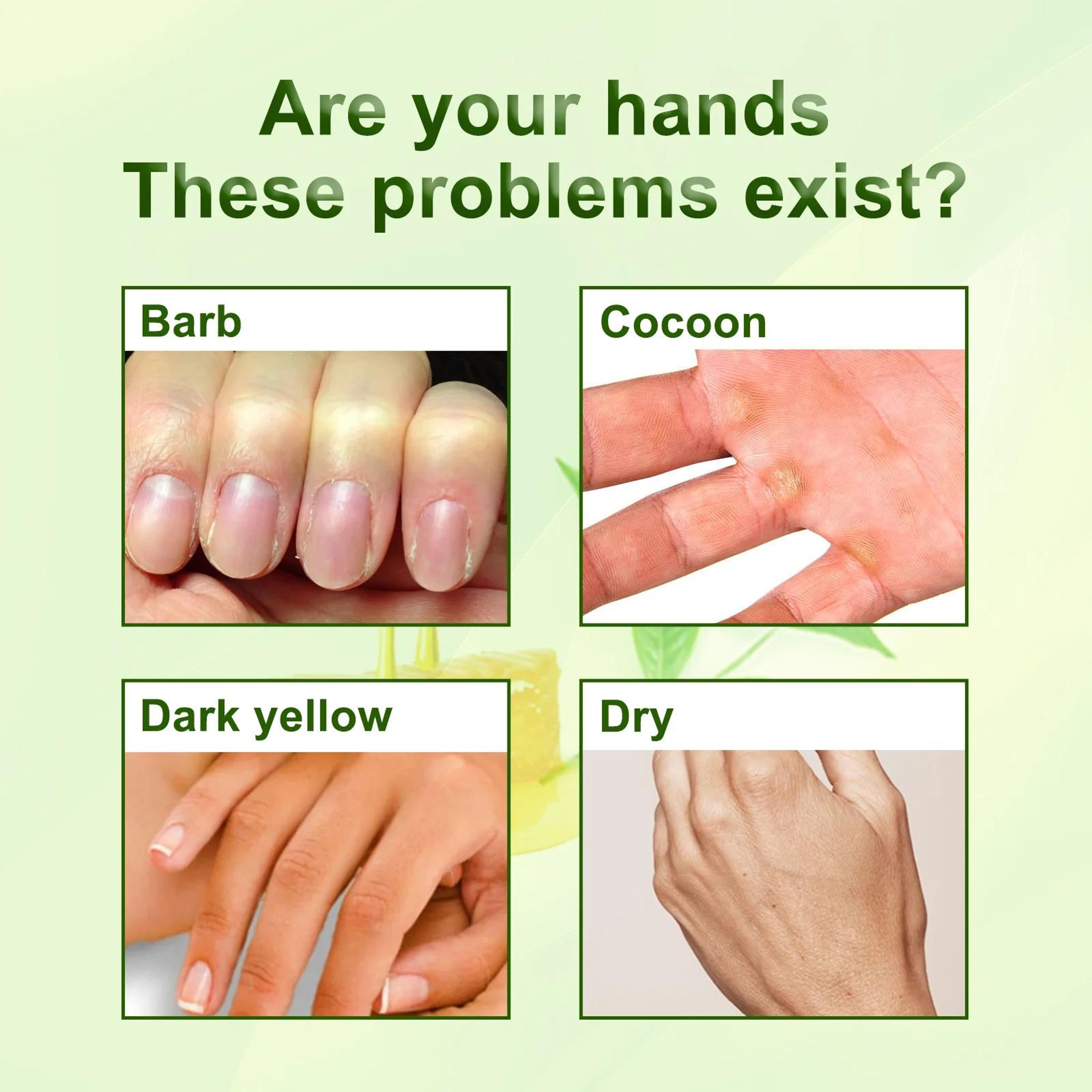 Green Tea Moisturizing And Exfoliating Hand Mask 4