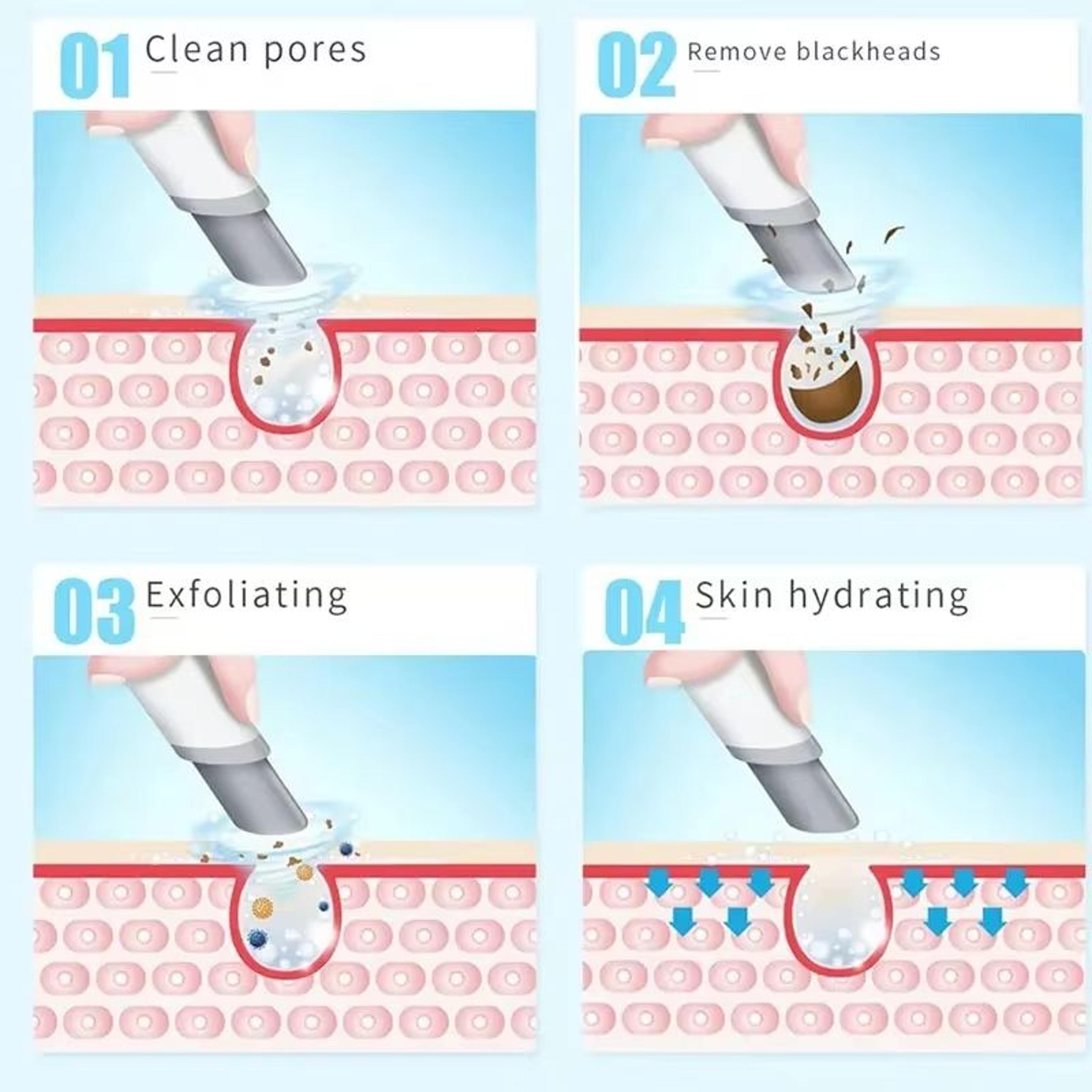 Hydra Dermabrasion Facial Device  Blackhead Remover  Oxygen Bubble Skin Cleaner 5