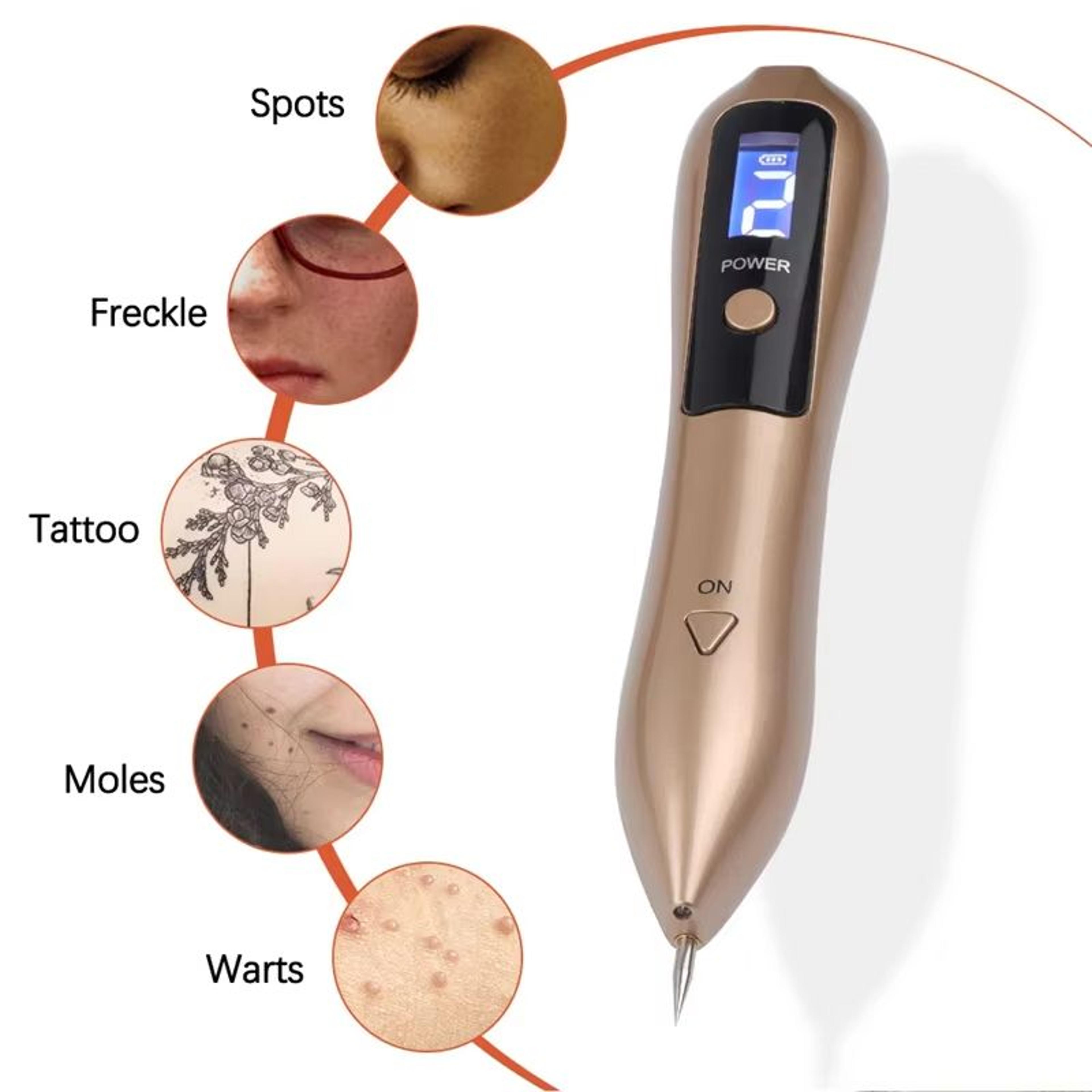 UBilli Plasma Beauty Pen  Laser Skin Tag Remover Freckle  Tattoo Removal Tool For Spot Care 2