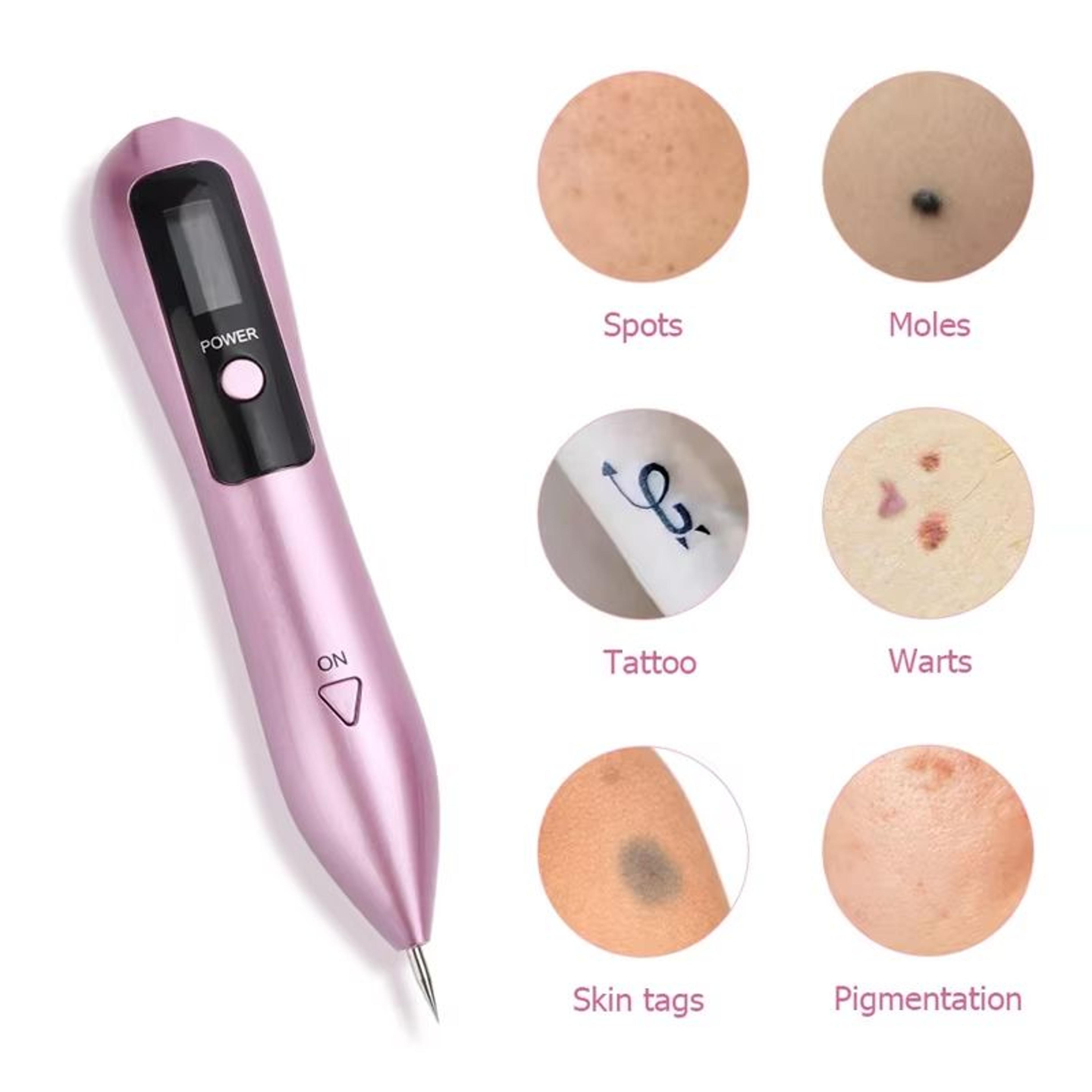 UBilli Plasma Beauty Pen  Laser Skin Tag Remover Freckle  Tattoo Removal Tool For Spot Care 5