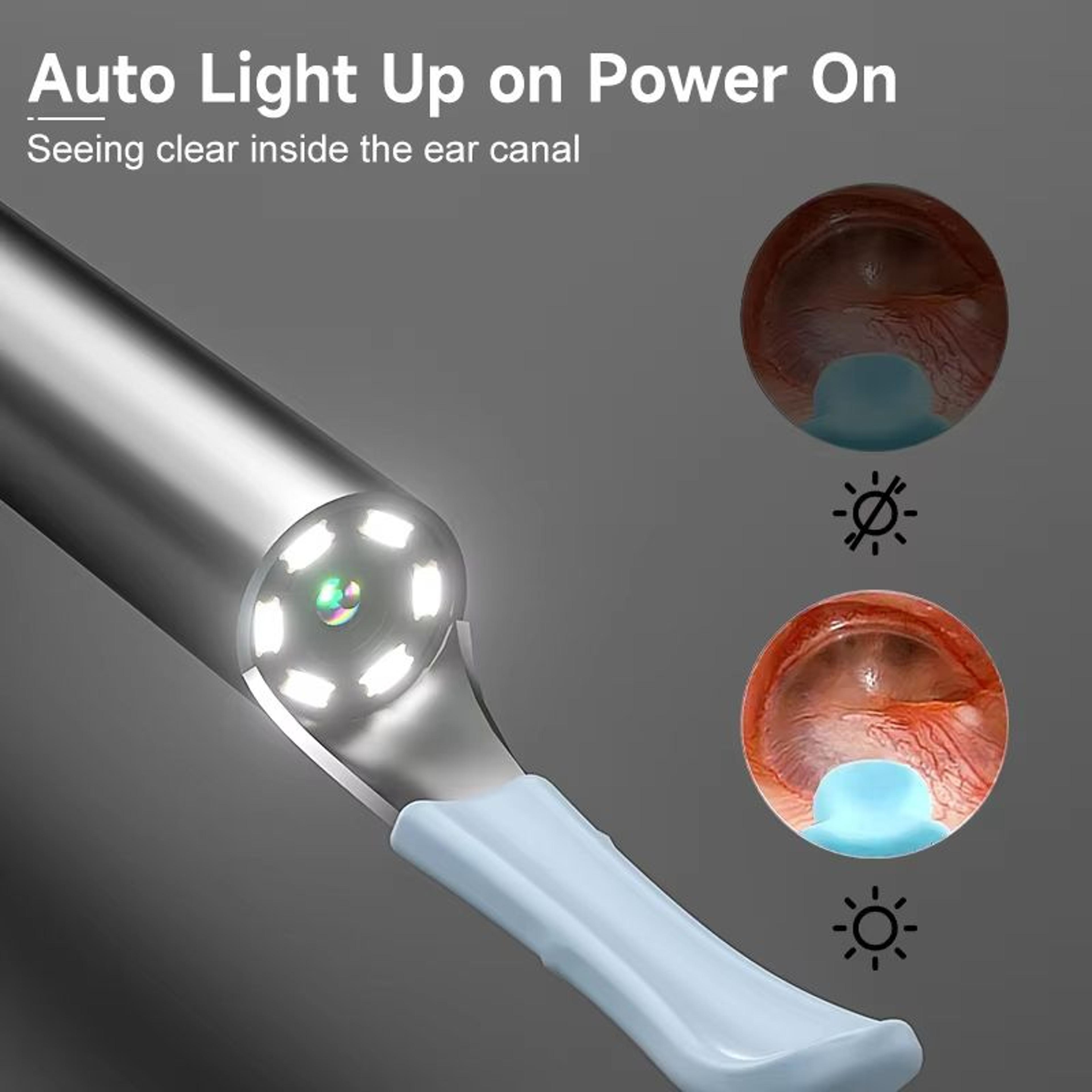 Smart Visual Ear Cleaner With HD 1080P Camera And WiFi Connectivity 3
