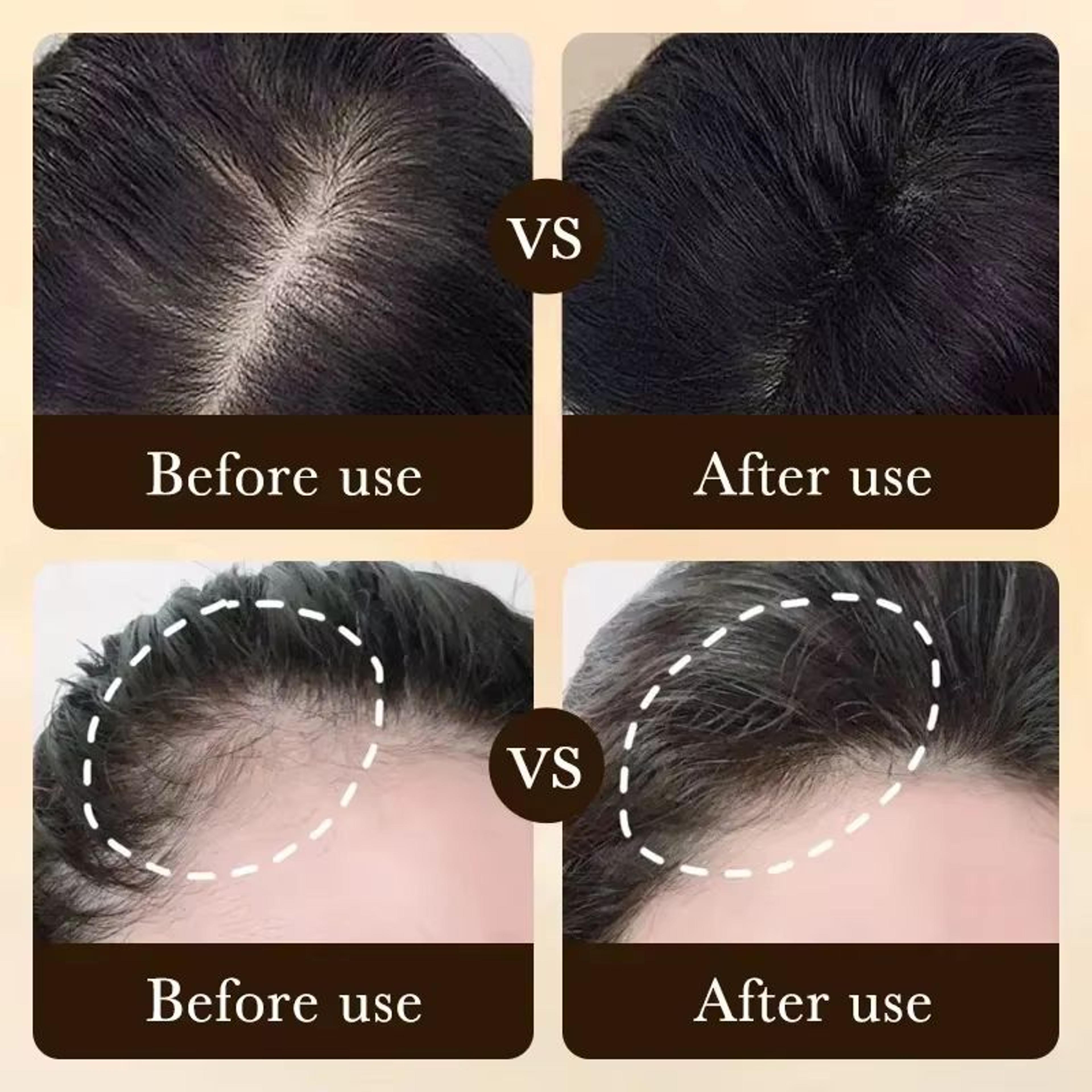 Vita Thick BiotinBoost Hair Growth Oil  Intensive Scalp  Hair Loss Repair Treatment 1