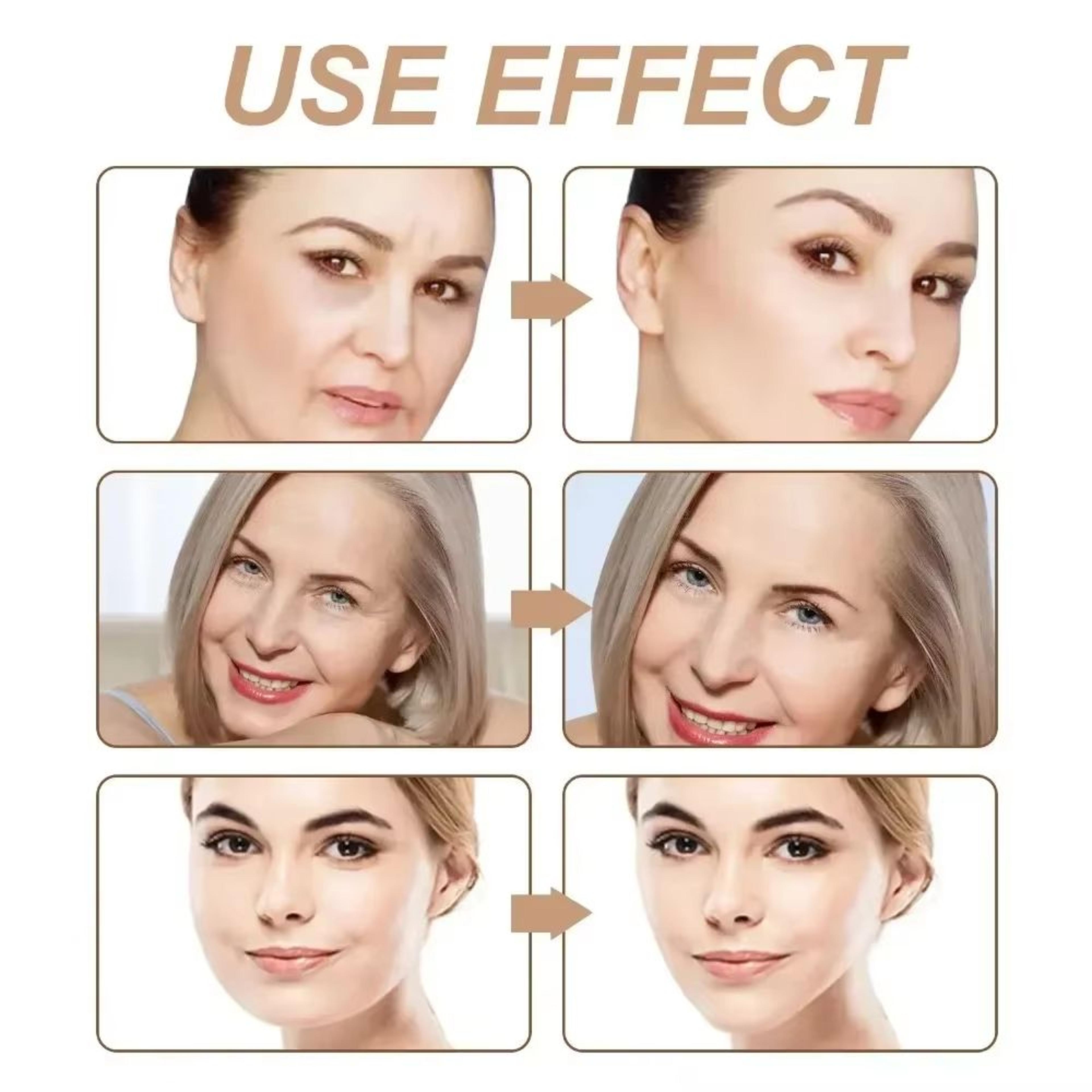 Kinesiology Face Lifting Tape Roll For V Line And Wrinkles 4