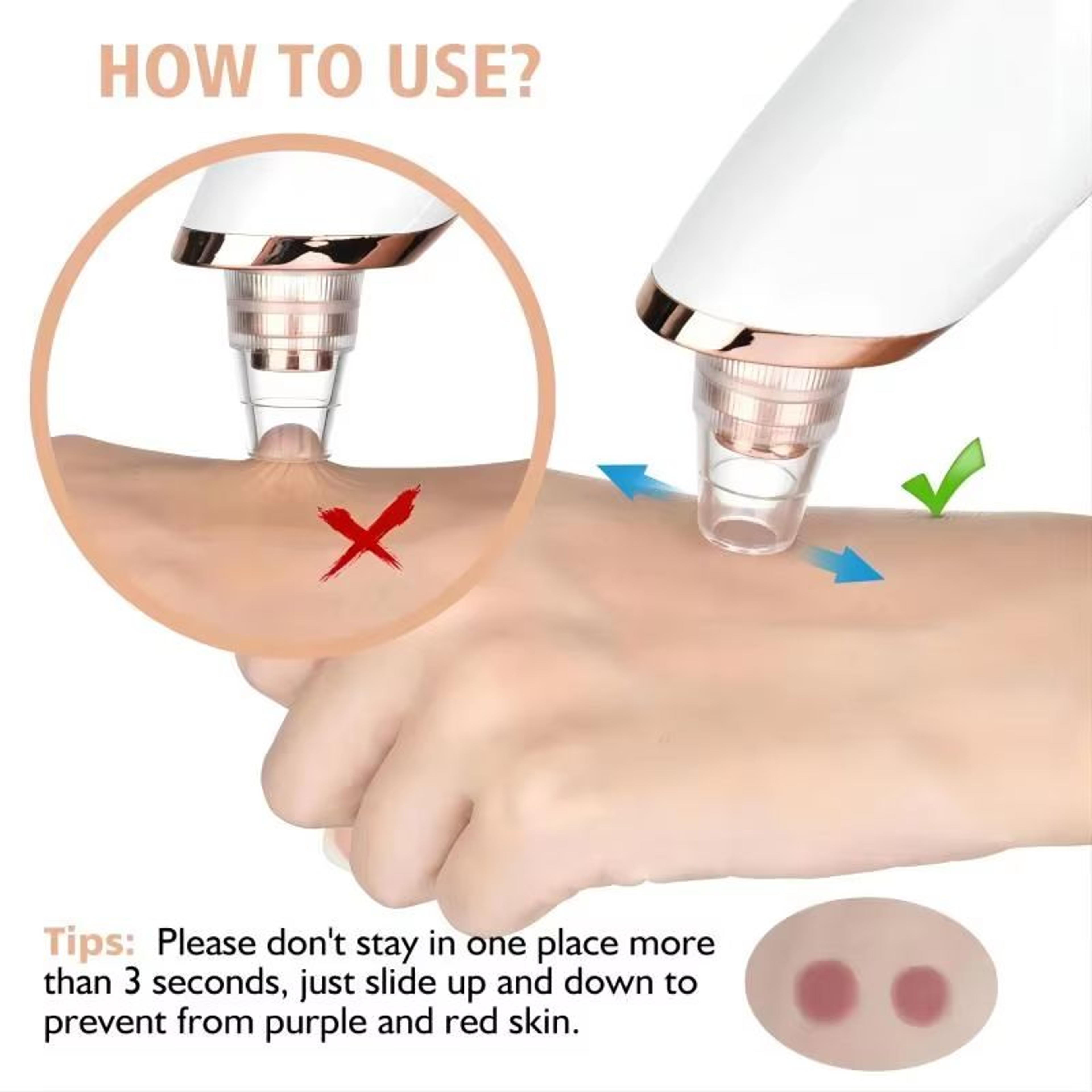 Electric Blackhead Remover Vacuum Pore Cleaner For Acne And Deep Facial Extraction 5