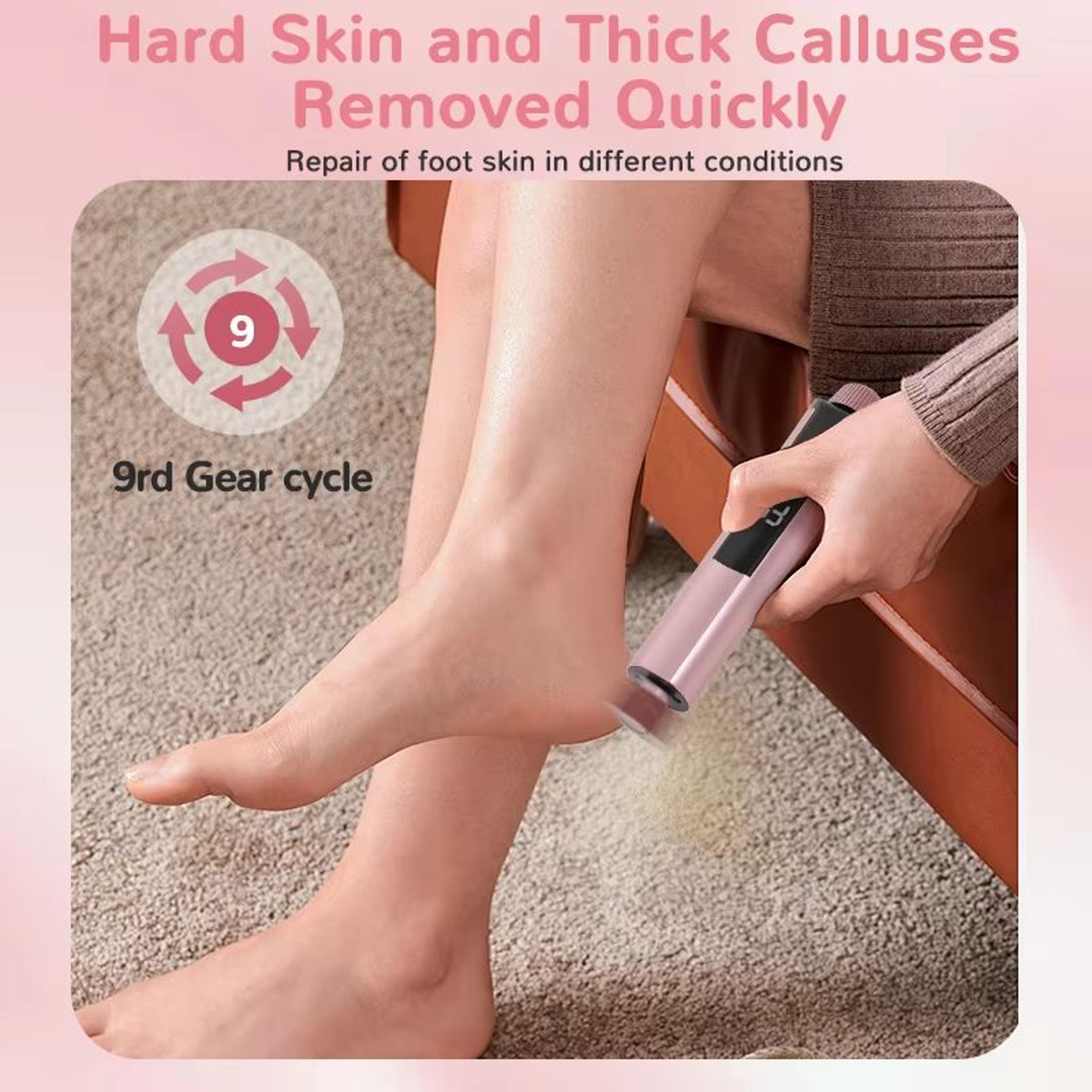 2in1 Electric Foot File  Callus Remover With Nail Grinder And Sandpaper Disks 1