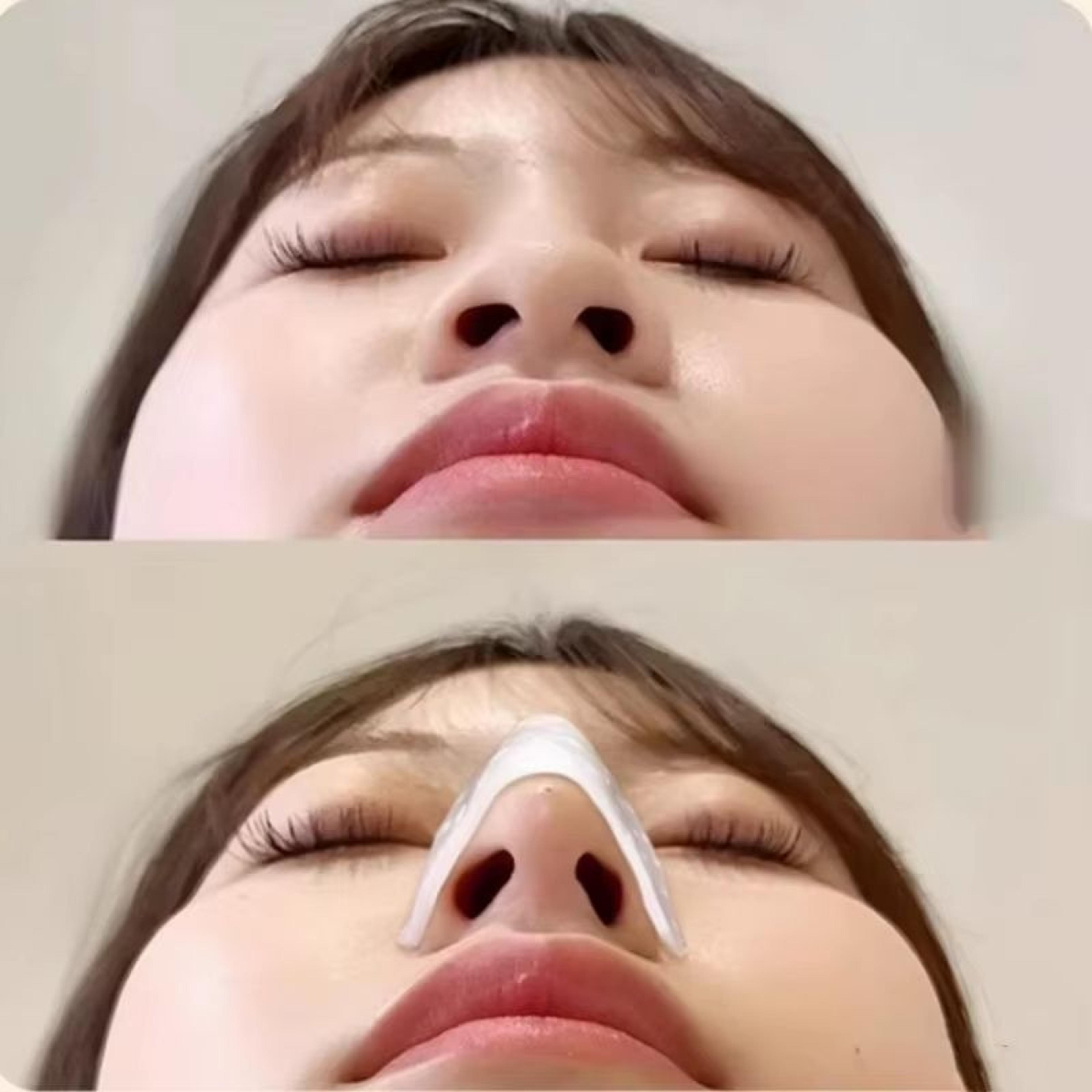 Thermoplastic Nose Clip Reusable SelfPinching Shaping Nose Fixer Beauty Tool 2