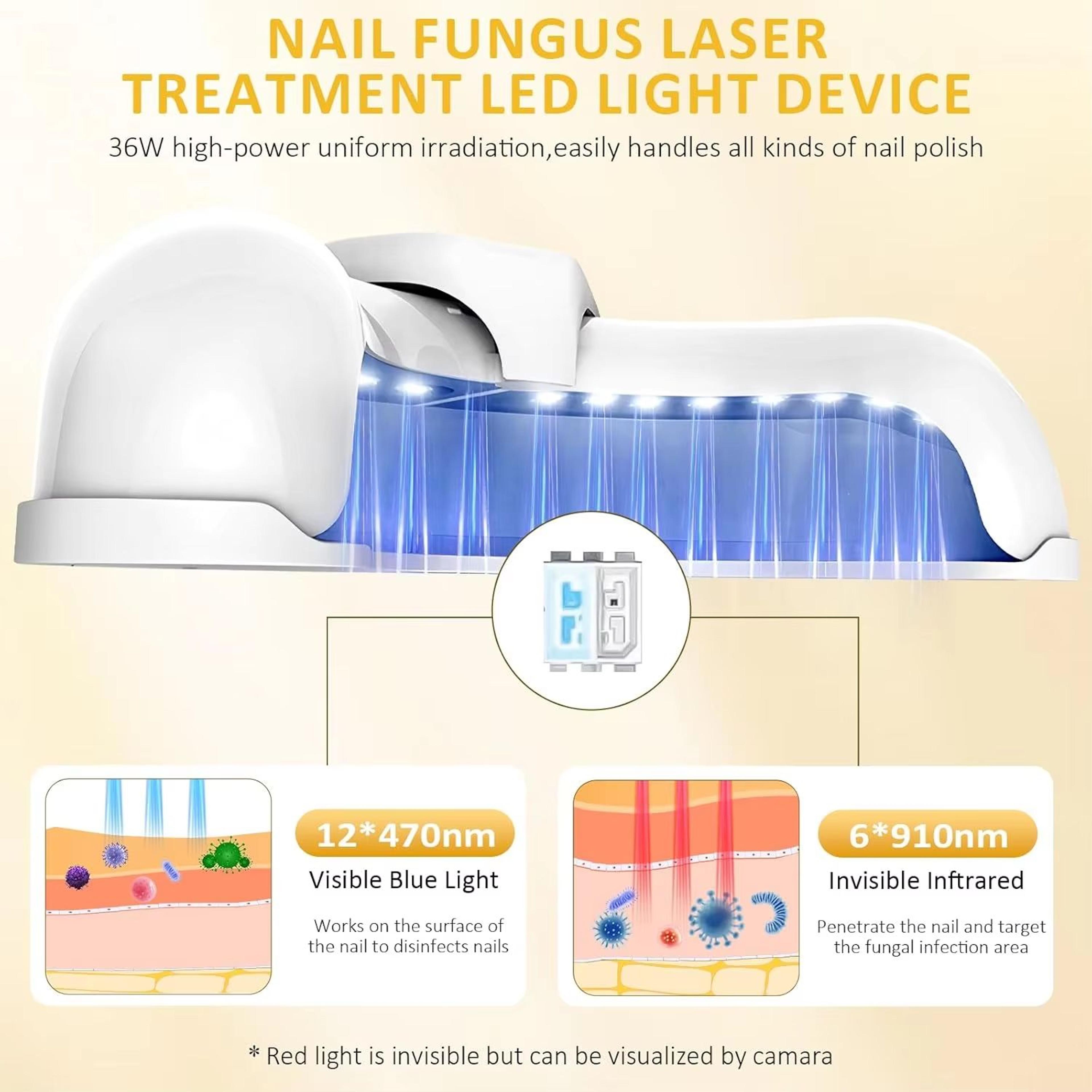 Portable Laser Nail Fungus Treatment Device For Onychomycosis And Ingrown Toenails 2