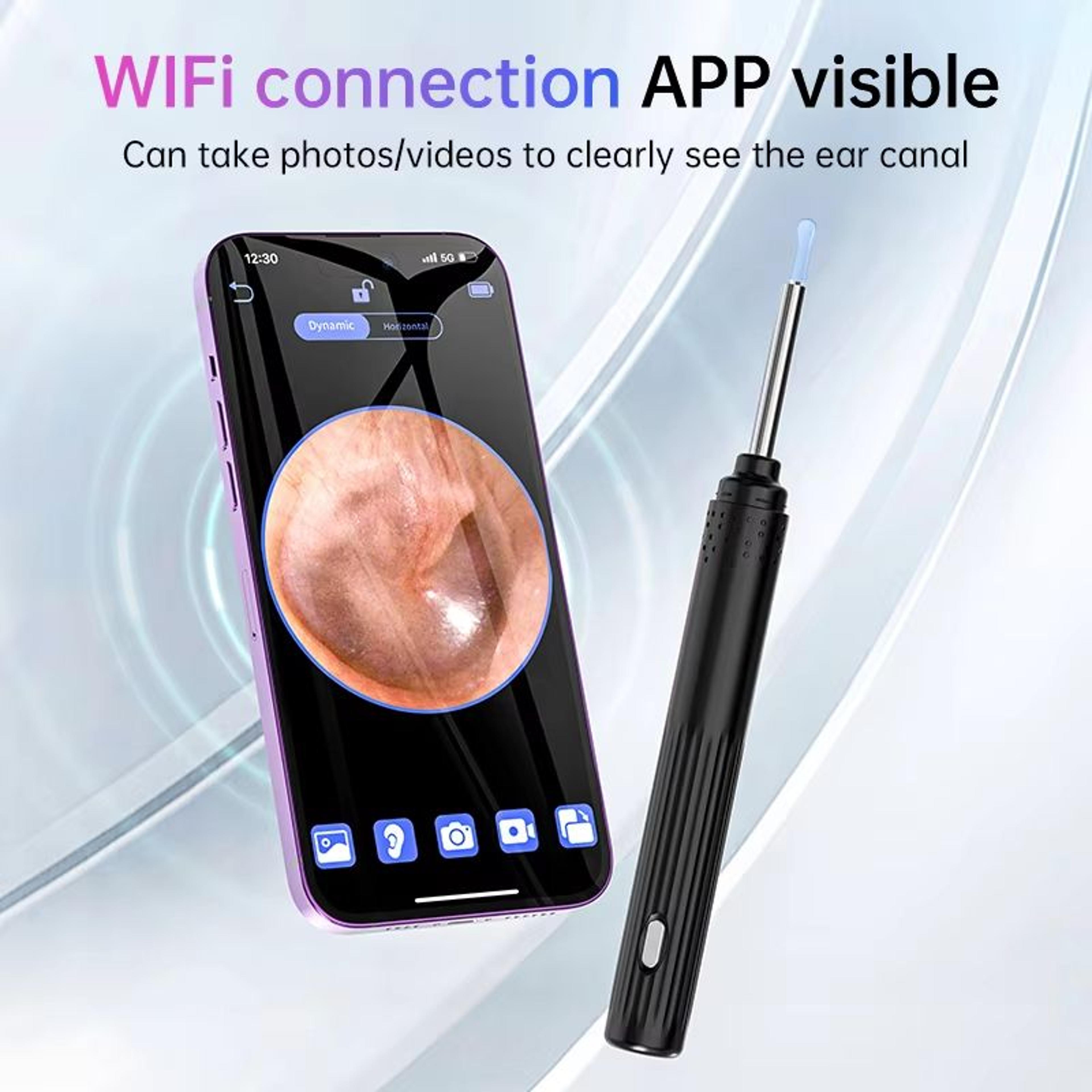 KERUI Smart Ear Wax Removal Kit With 5MP HD Camera And Light Endoscope Otoscope 2