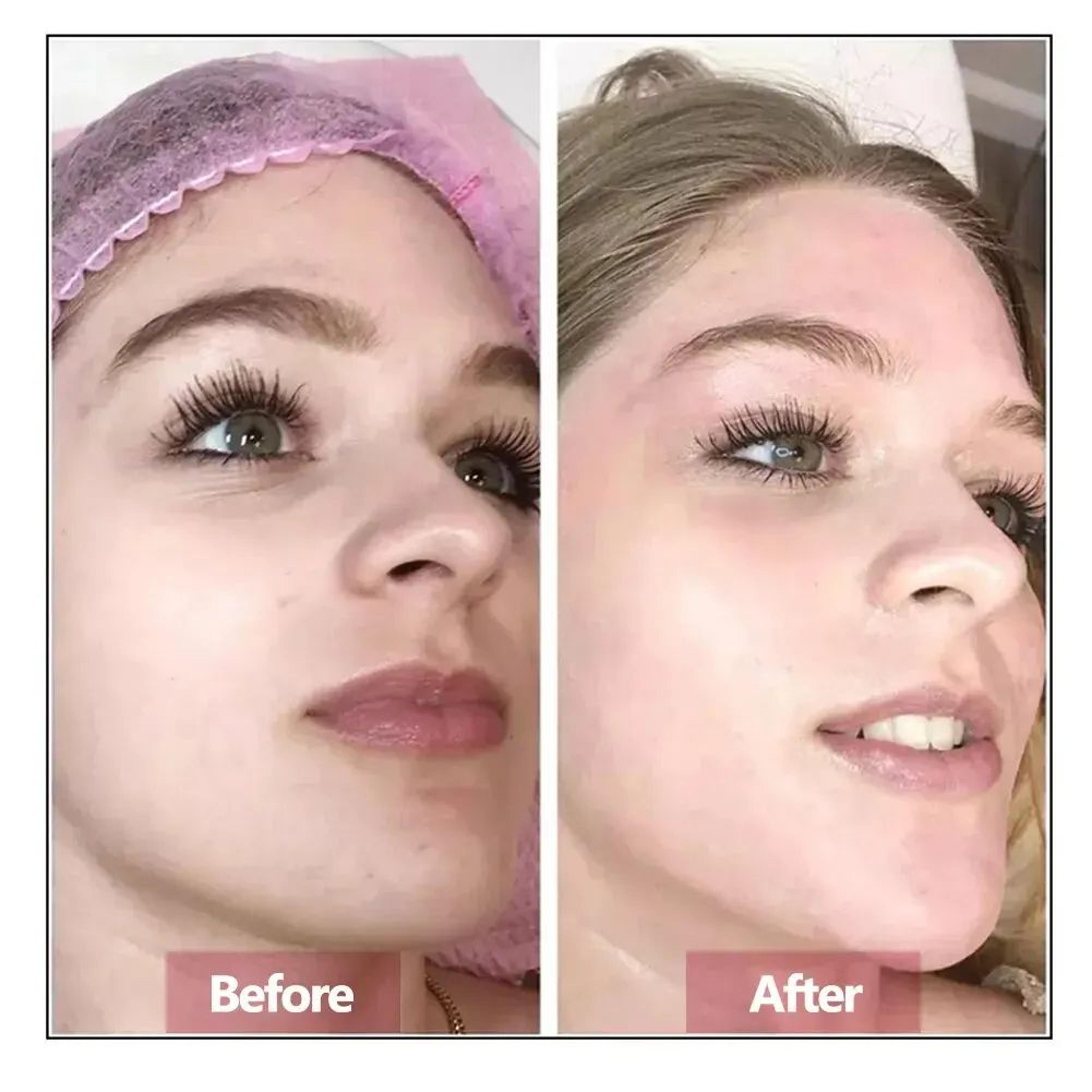 Hyaluronic Acid Face Serum Essence Hydrating Moisturizing AntiAging Skin Repair 2