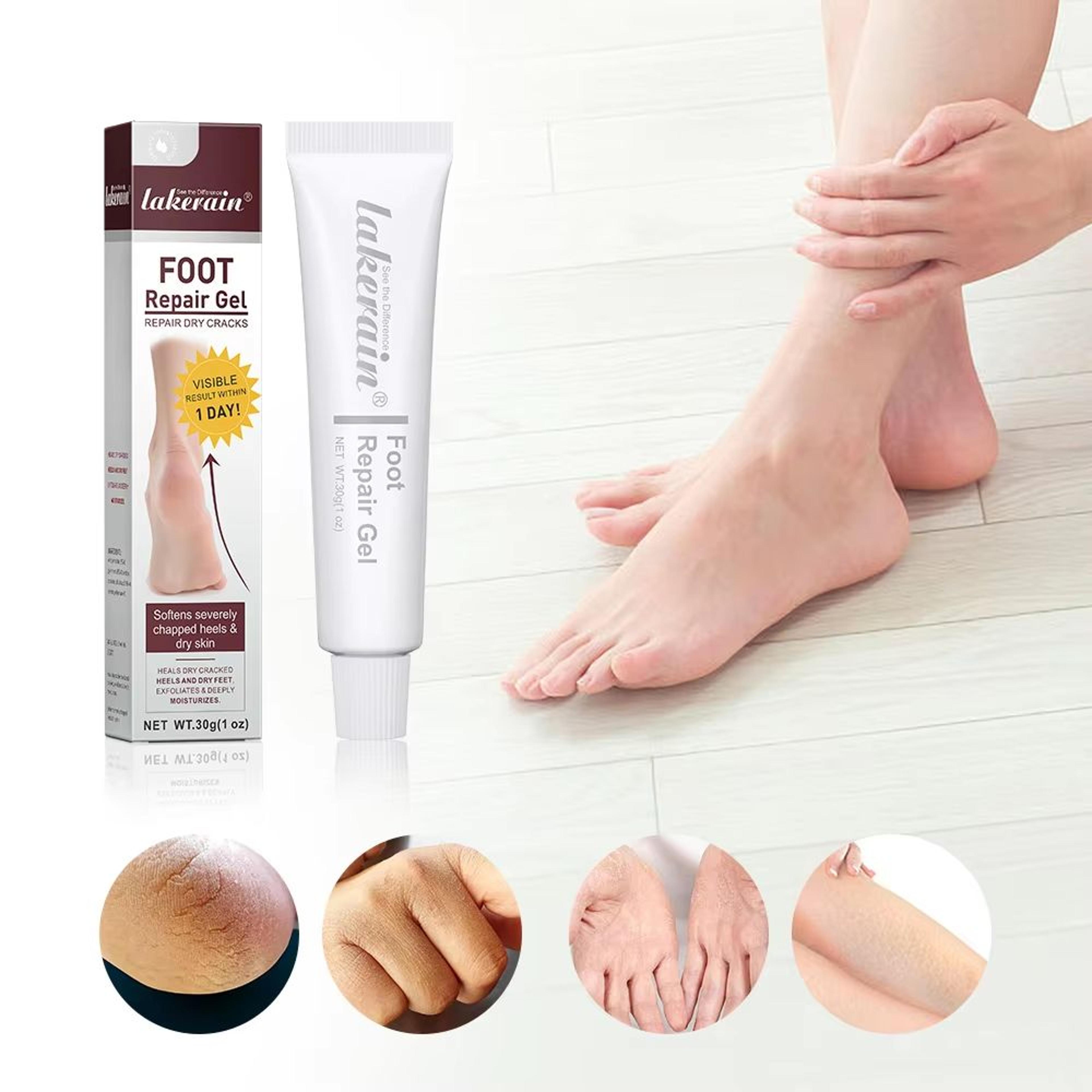 Intensive Foot Repair Gel Mask Cracked Heel Exfoliating Foot Cream For Hands  Feet 30g 2