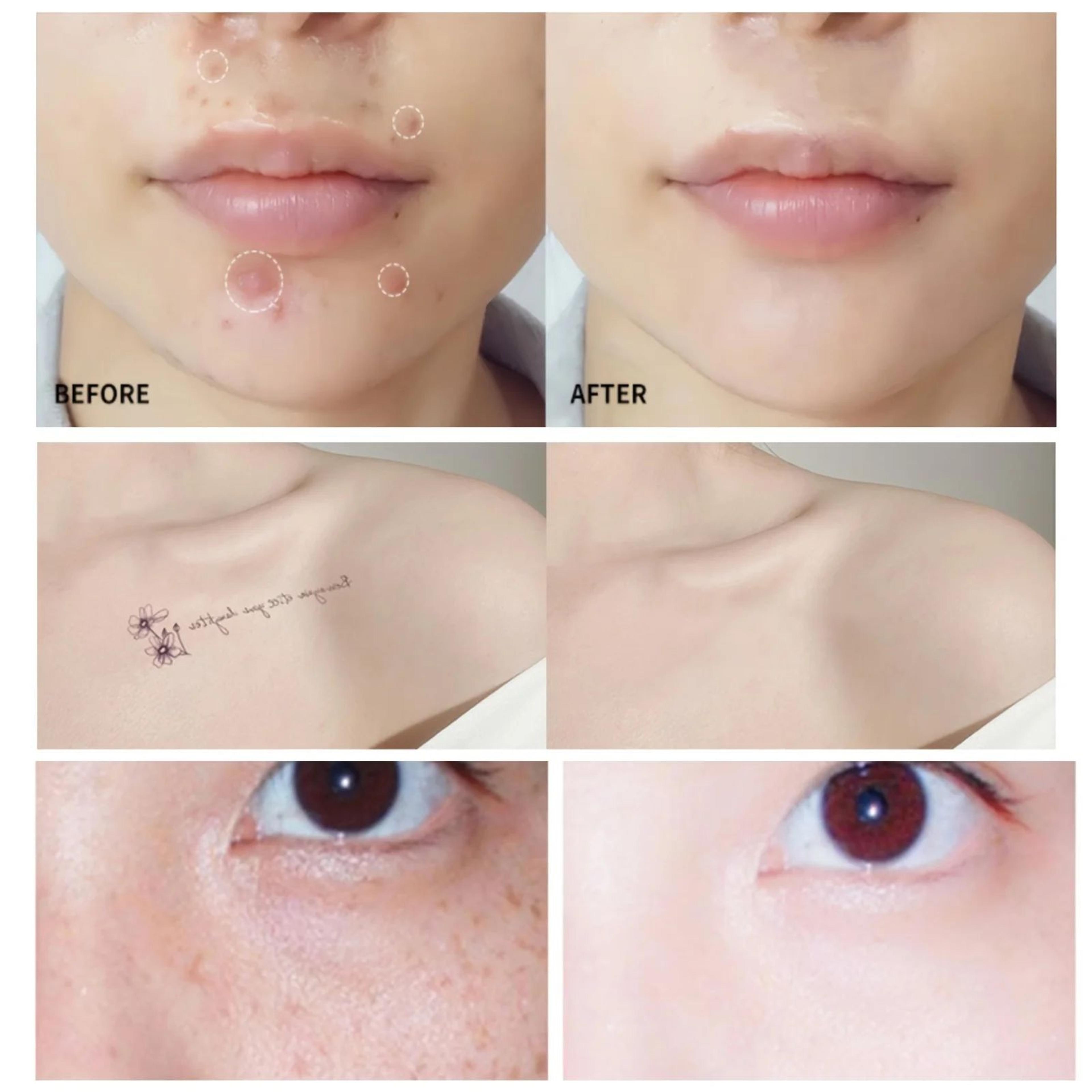 Waterproof Cream Concealer Palette  Full Coverage Spot  Dark Circle Corrector 5