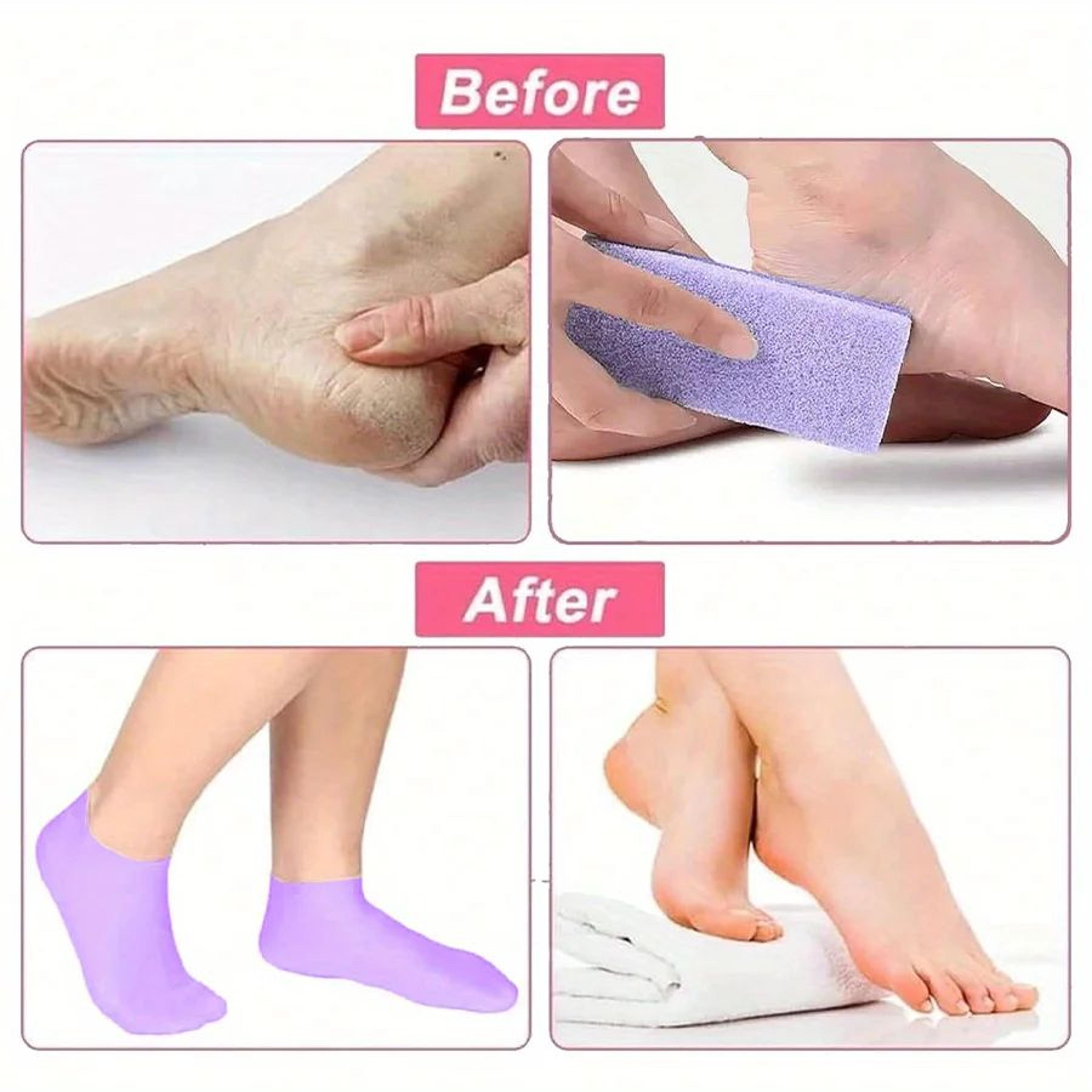 Silicone Moisturizing Foot Socks For Dry Cracked Heels And Overnight Repair 4