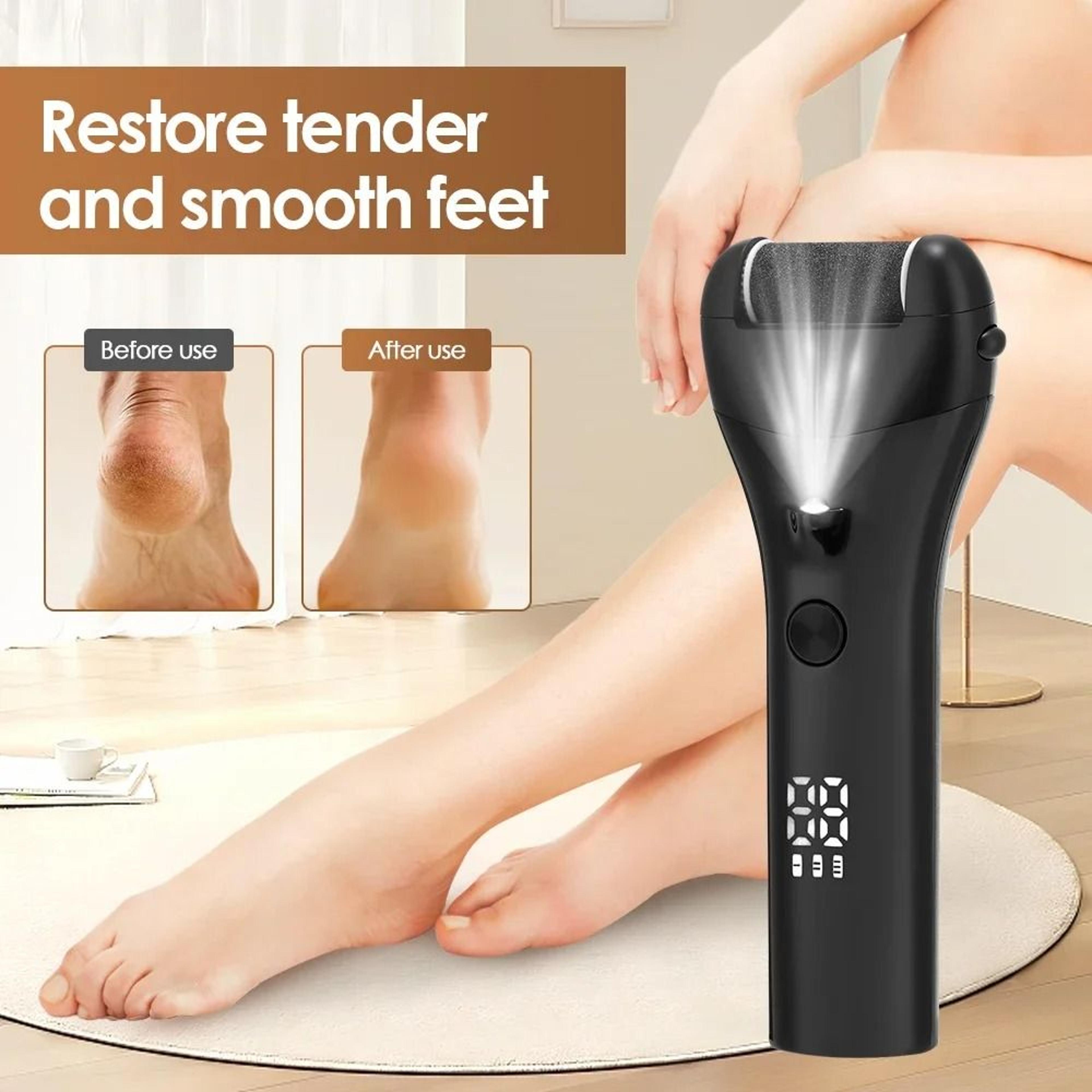 Professional Electric Foot Callus Remover With 3 Roller Heads IPX4 Waterproof Rechargeable Foot Fil 1