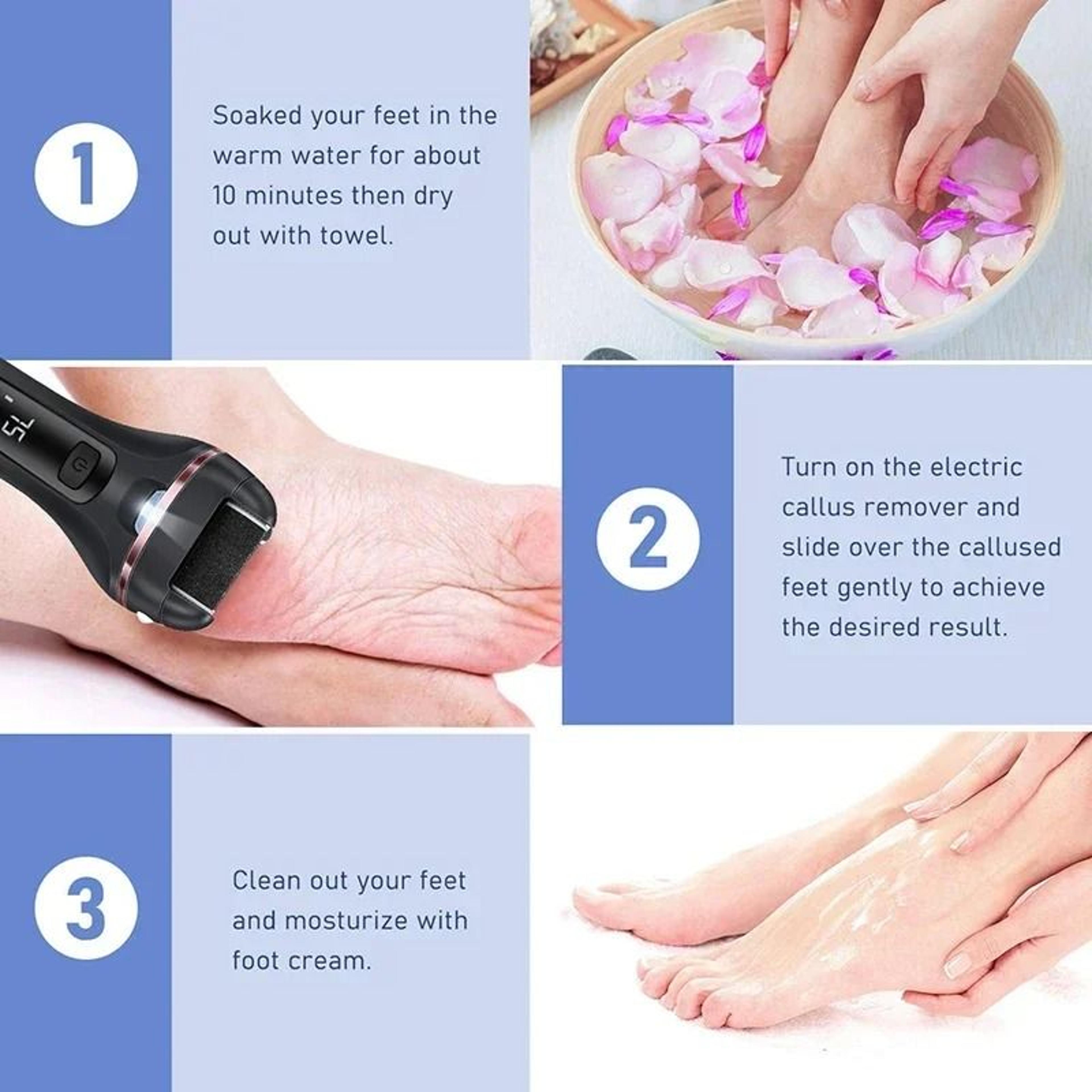 Professional Electric Foot Grinder Callus Remover For Smooth Soft Feet 4