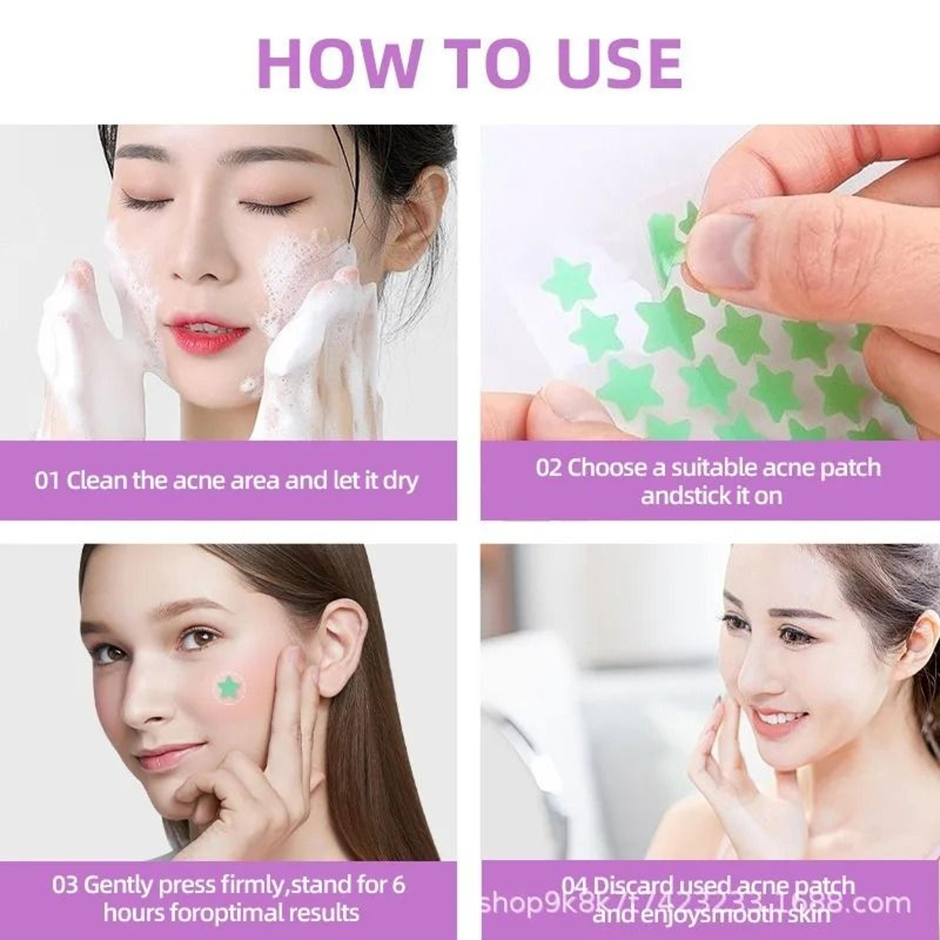 280 Piece Star Pimple Patches For Acne Care And Blemish Protection 4