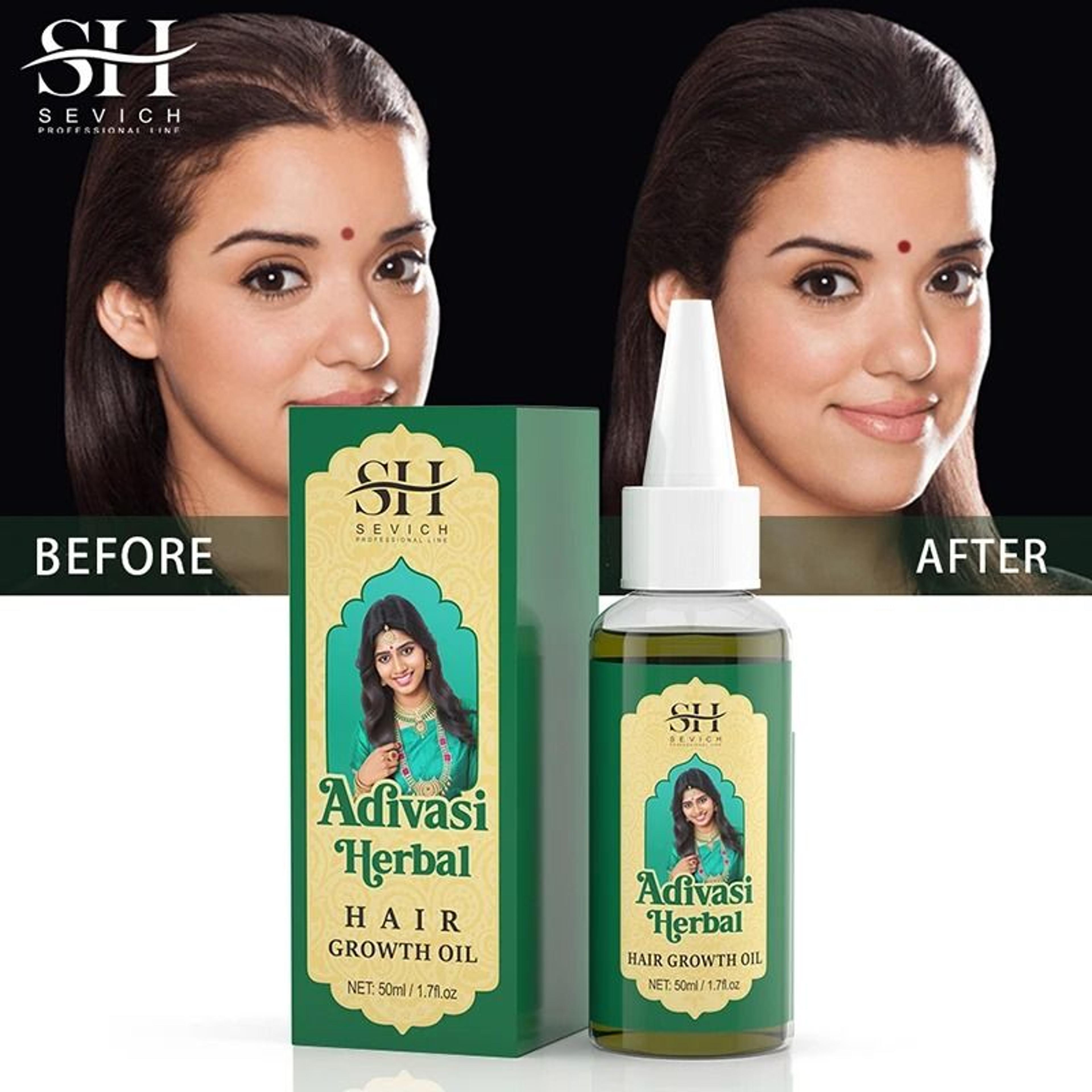 Ayurvedic Hair Growth Oil Organic Serum Anti Hair Loss Regrowth 4