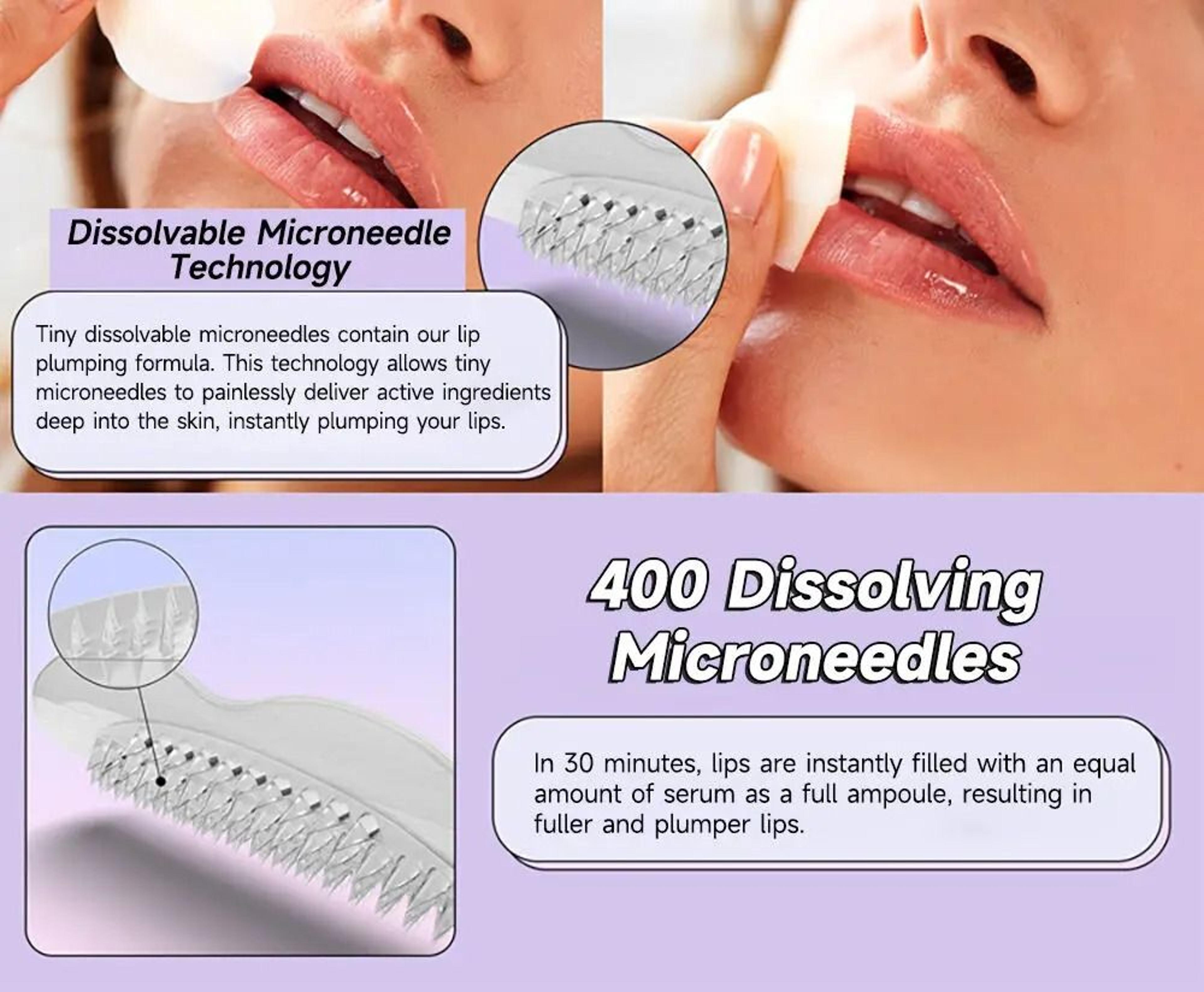 Smile Lift Firm Lips Patch Hyaluronic Acid Microneedle Lip Patches For Anti Wrinkle Mouth 4