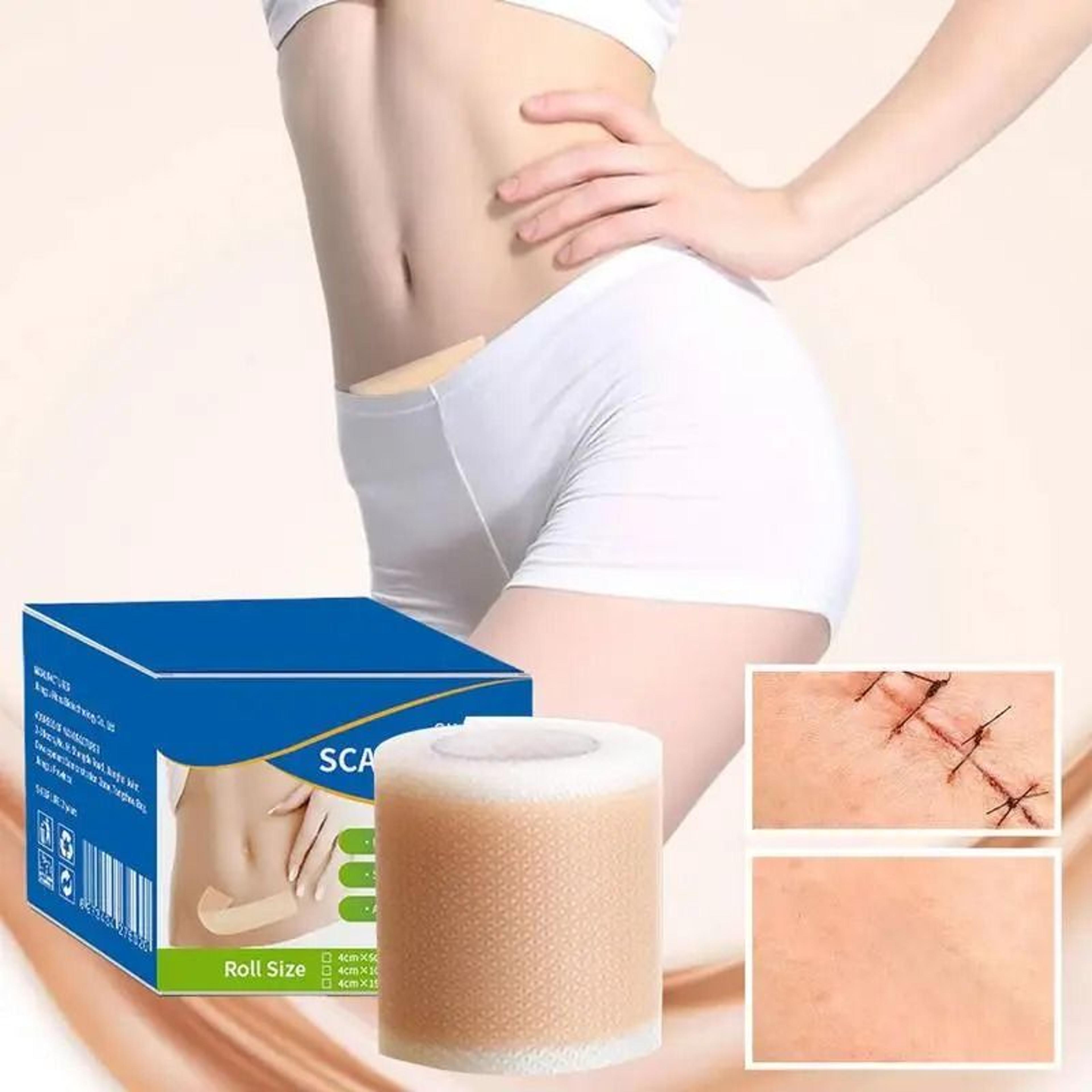 Soft Reusable Silicone Scar Tape For Gentle Scar Care 3