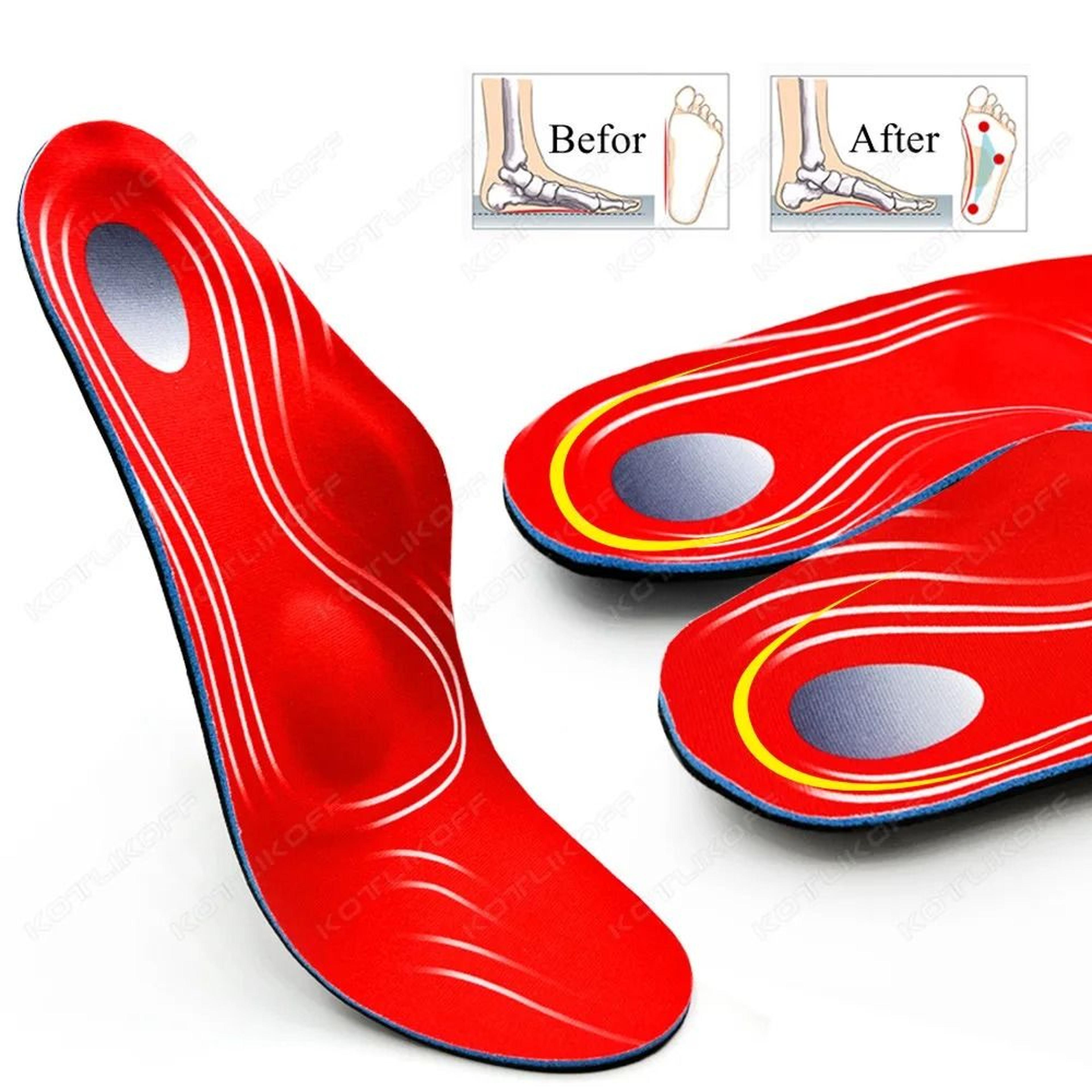 Orthotic Arch Support Insoles For Flat Feet And Plantar Fasciitis 5
