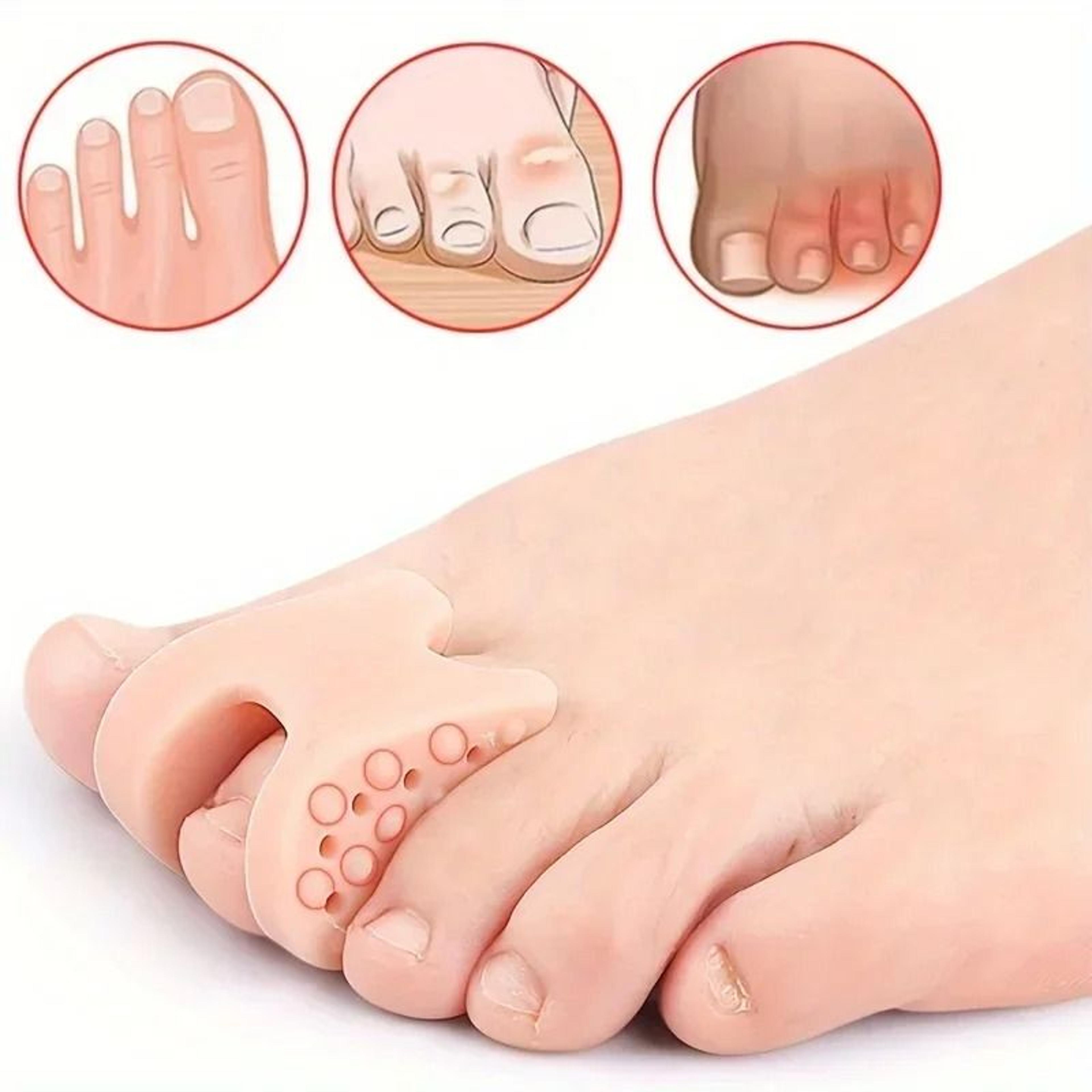 Soft Rubber Toe Spacer Set With Big Toe Separator And Toe Pad For Daily Alignment Support 2