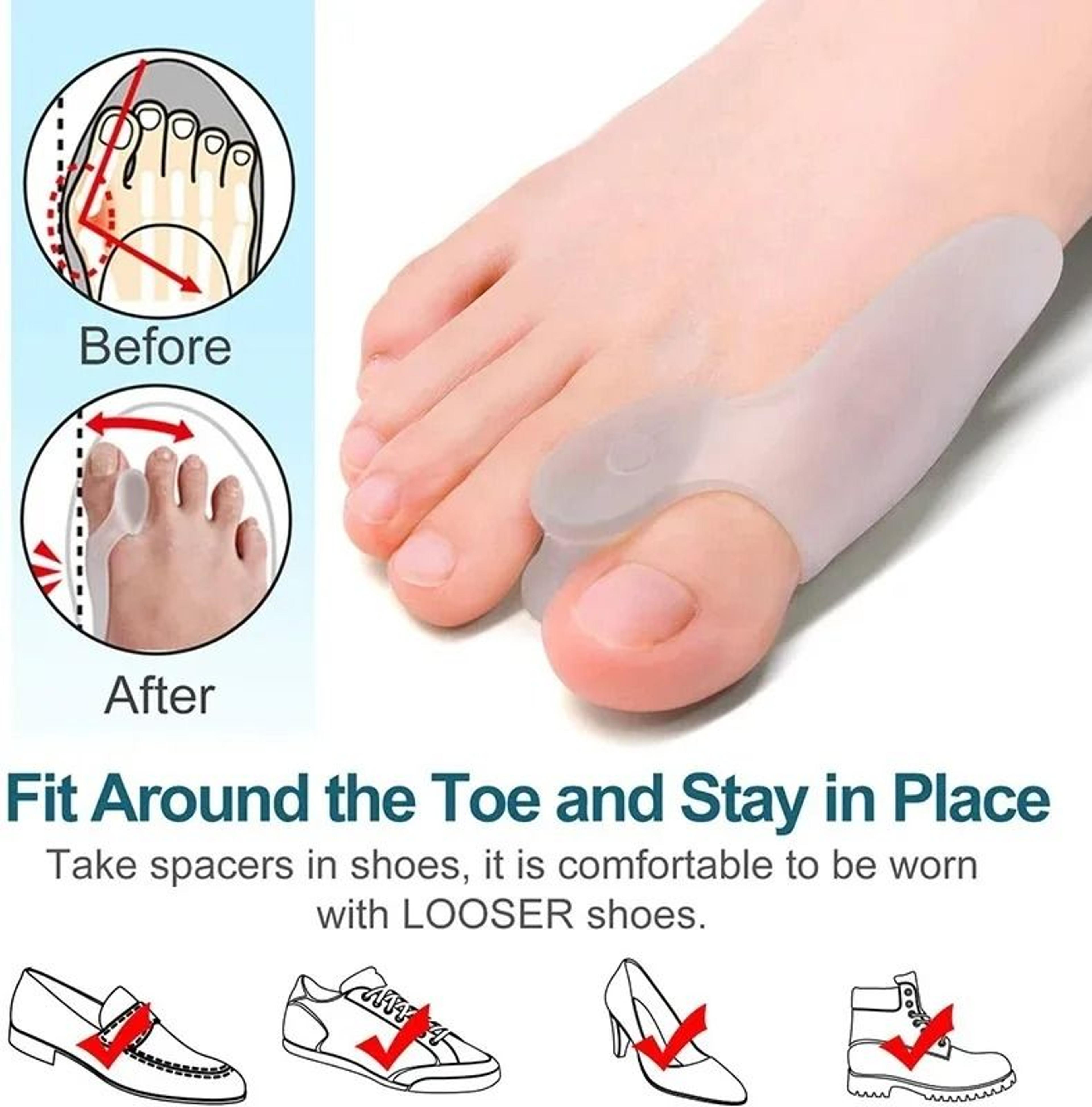 Soft Big Toe Corrector For Bunion Relief Comfortable Gel Separator For Night And Home Use 5