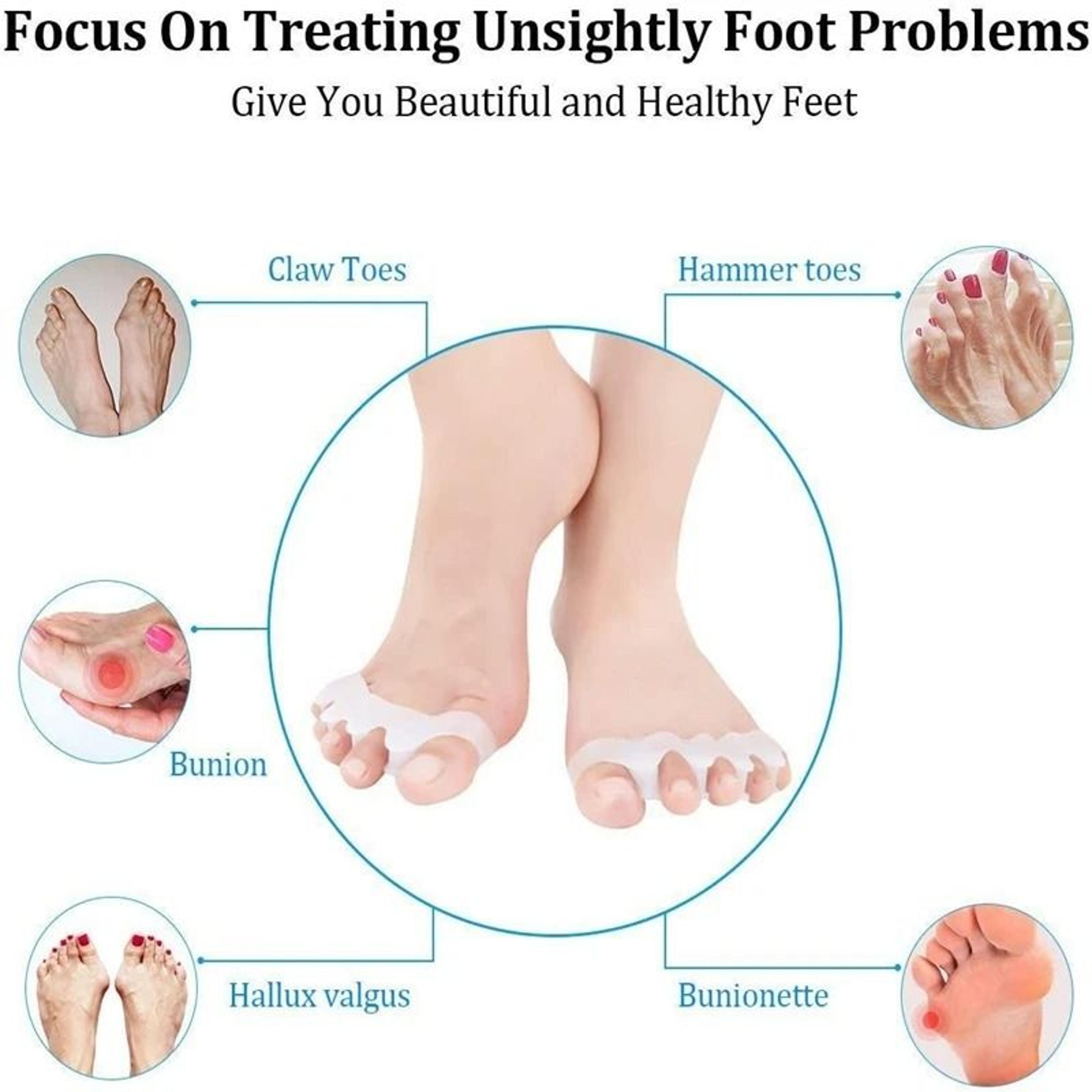 Protective Toe Separator Gel Straightener For Bunion And Hammer Toe Relief 3