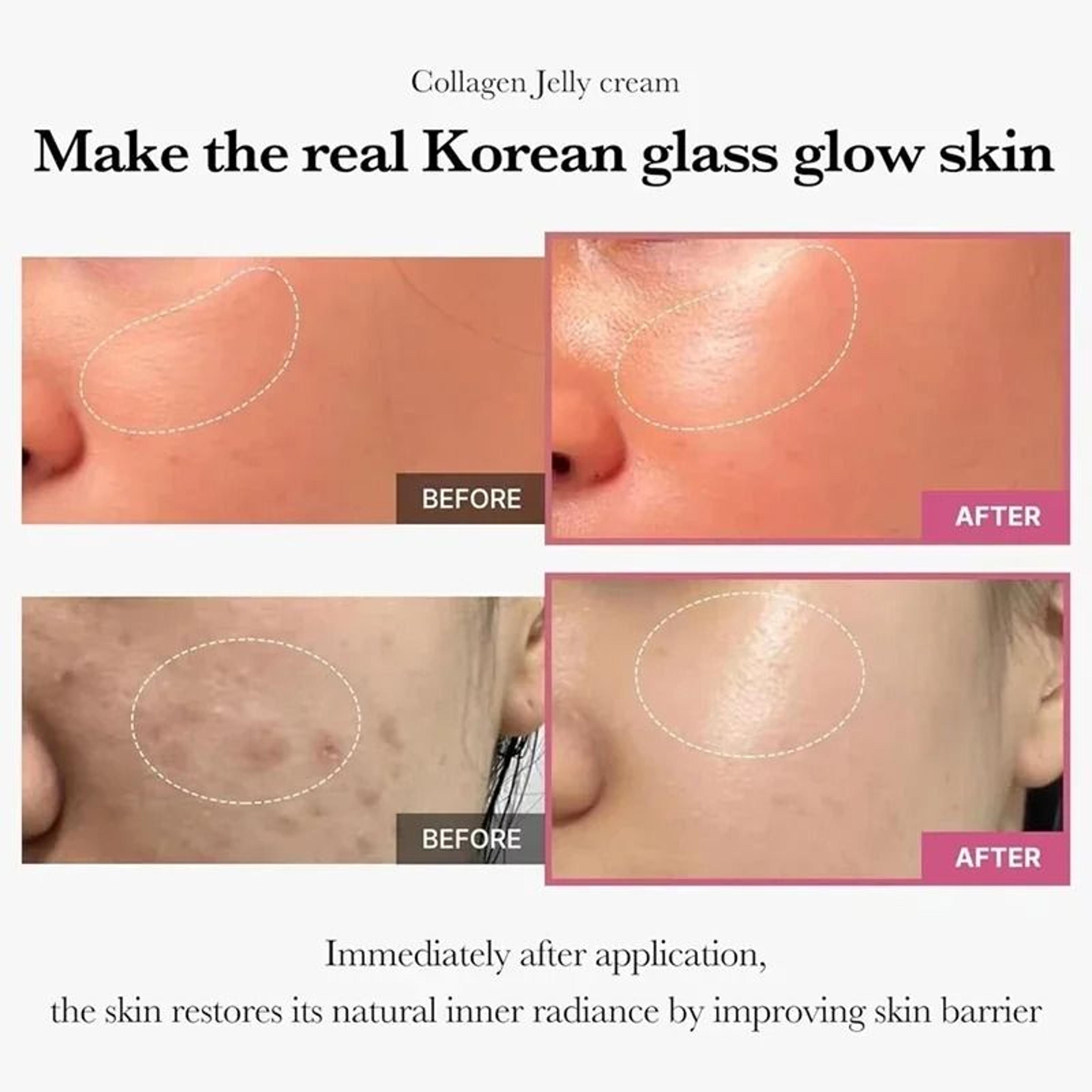 100g Jelly Face Cream Collagen Moisturizing Korean Skin Care 1