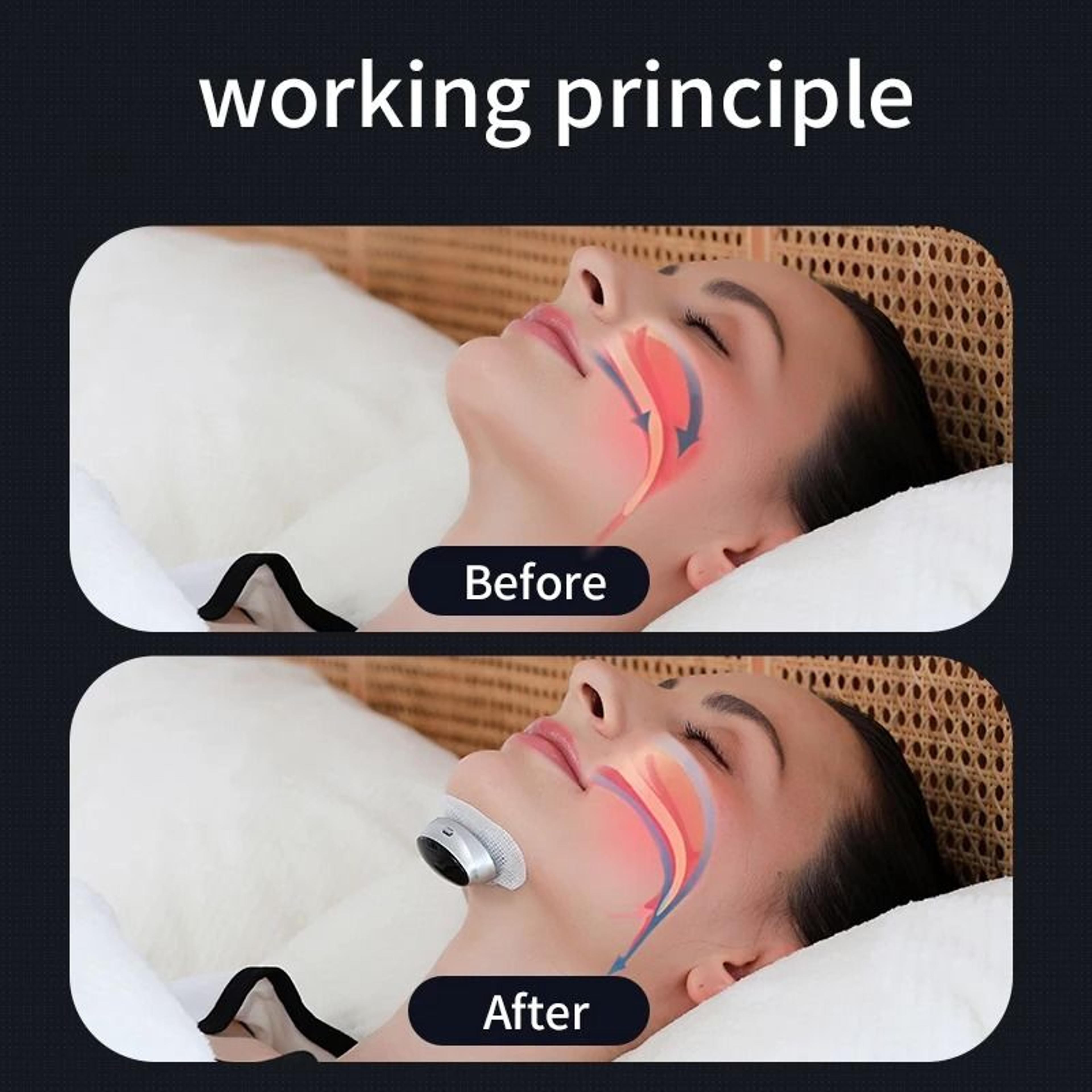 Smart Anti Snoring Device Magnetic EMS Sleep Aid For Better Breathing 3