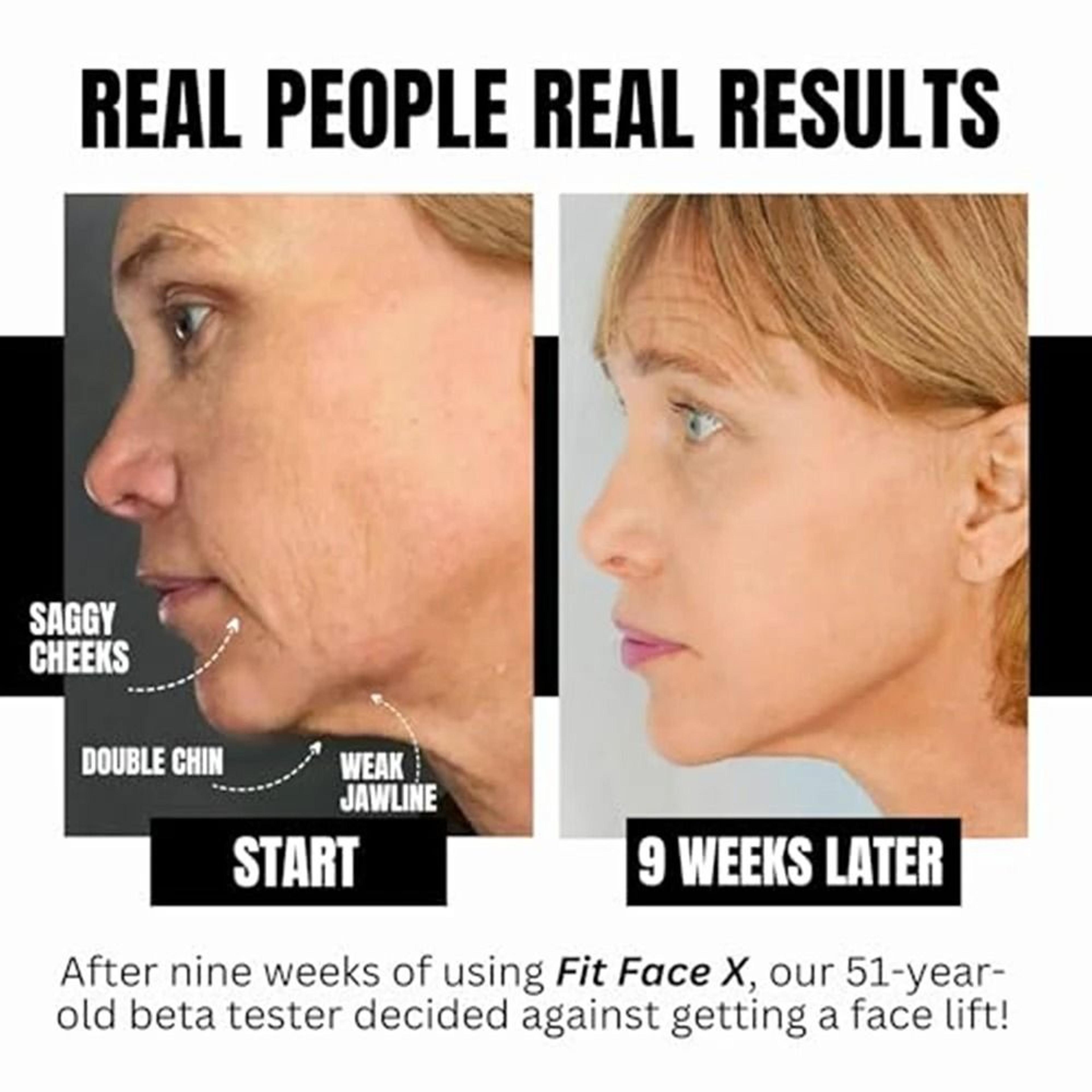 Face Sculpting Gym  4Tool Professional Lifting System 5