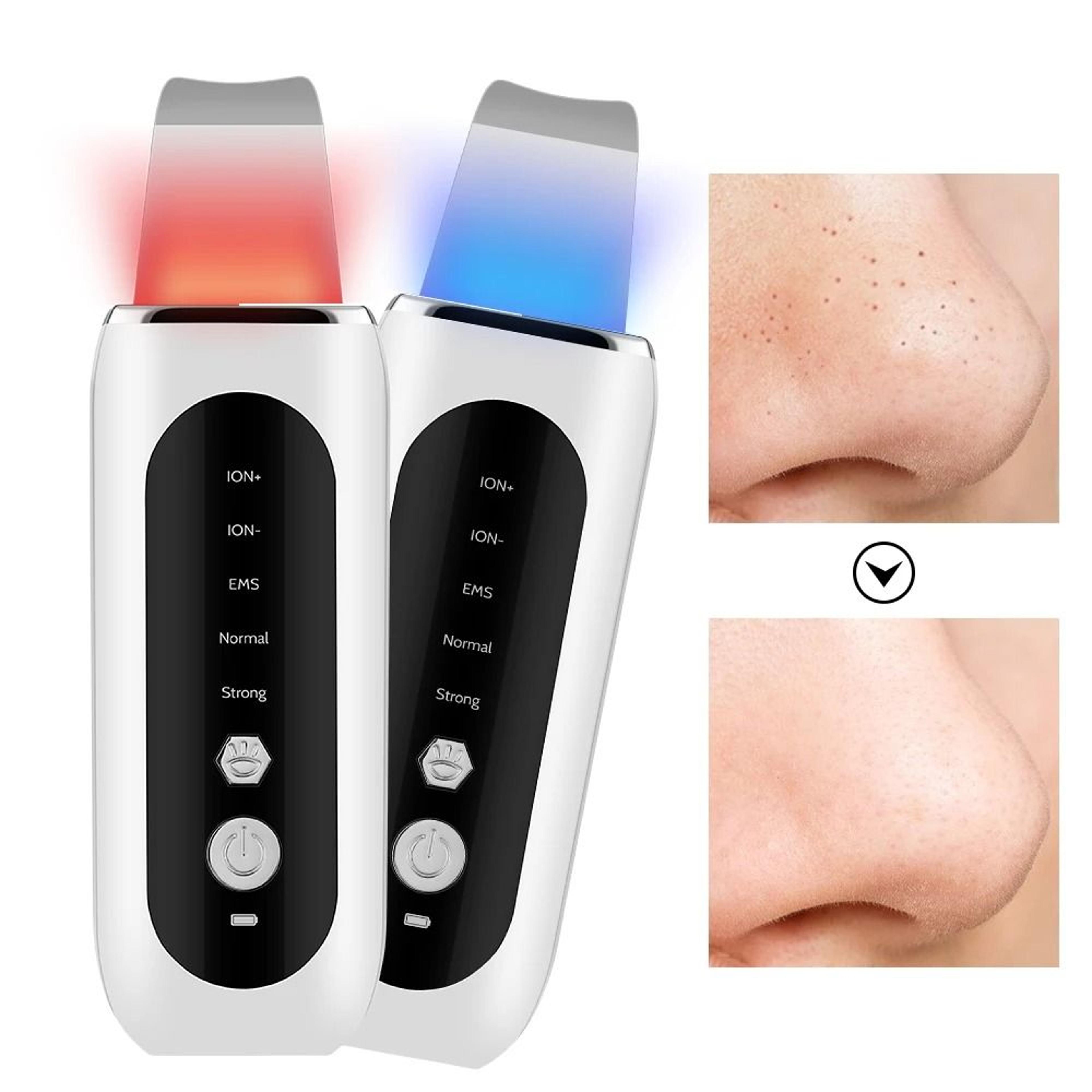 ultrasonic ion blackhead remover & facial peeling skin scrubber